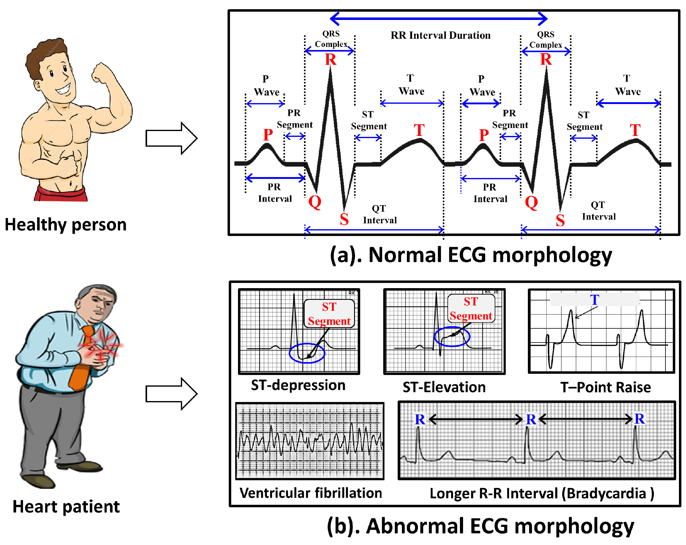 Sensors 18 00379 g003 550