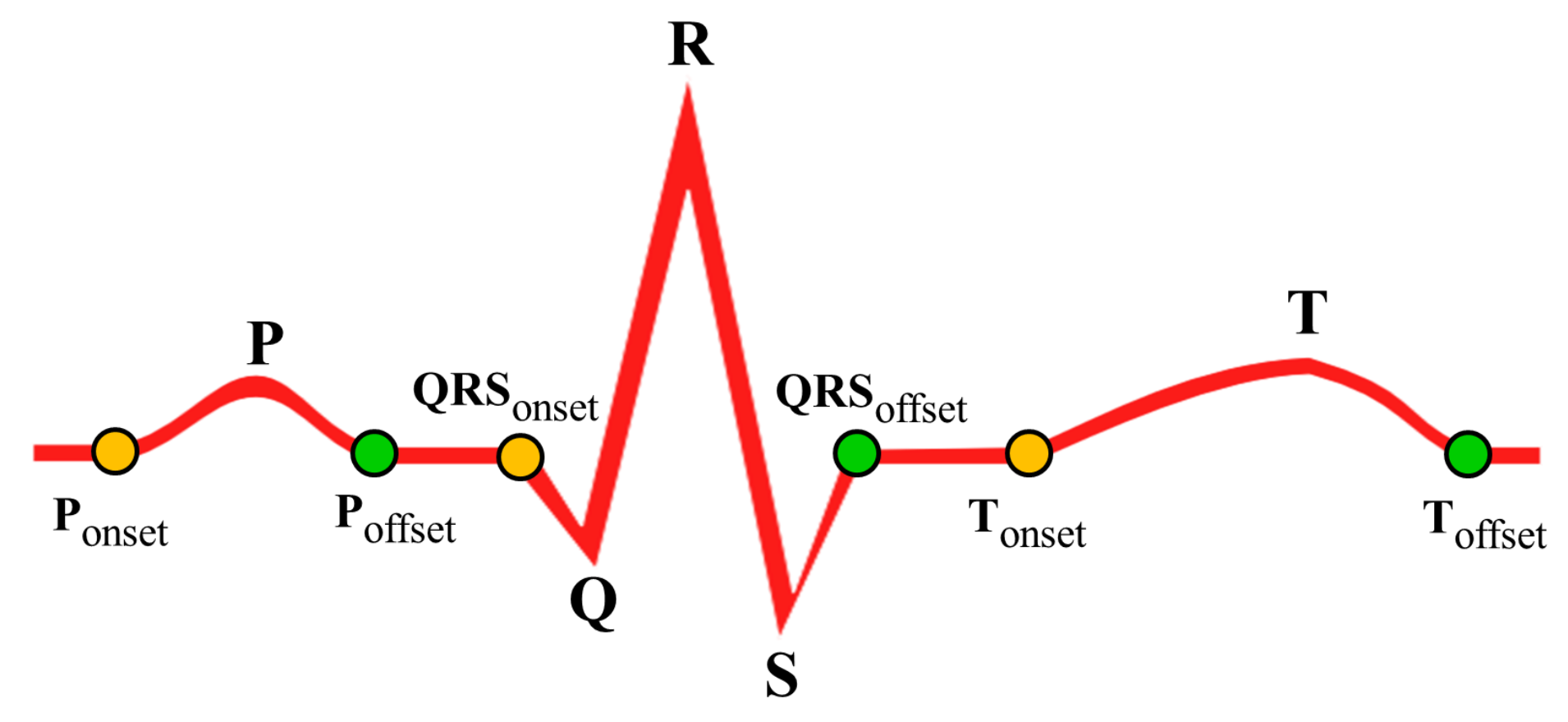 Sensors 18 00379 g007 550