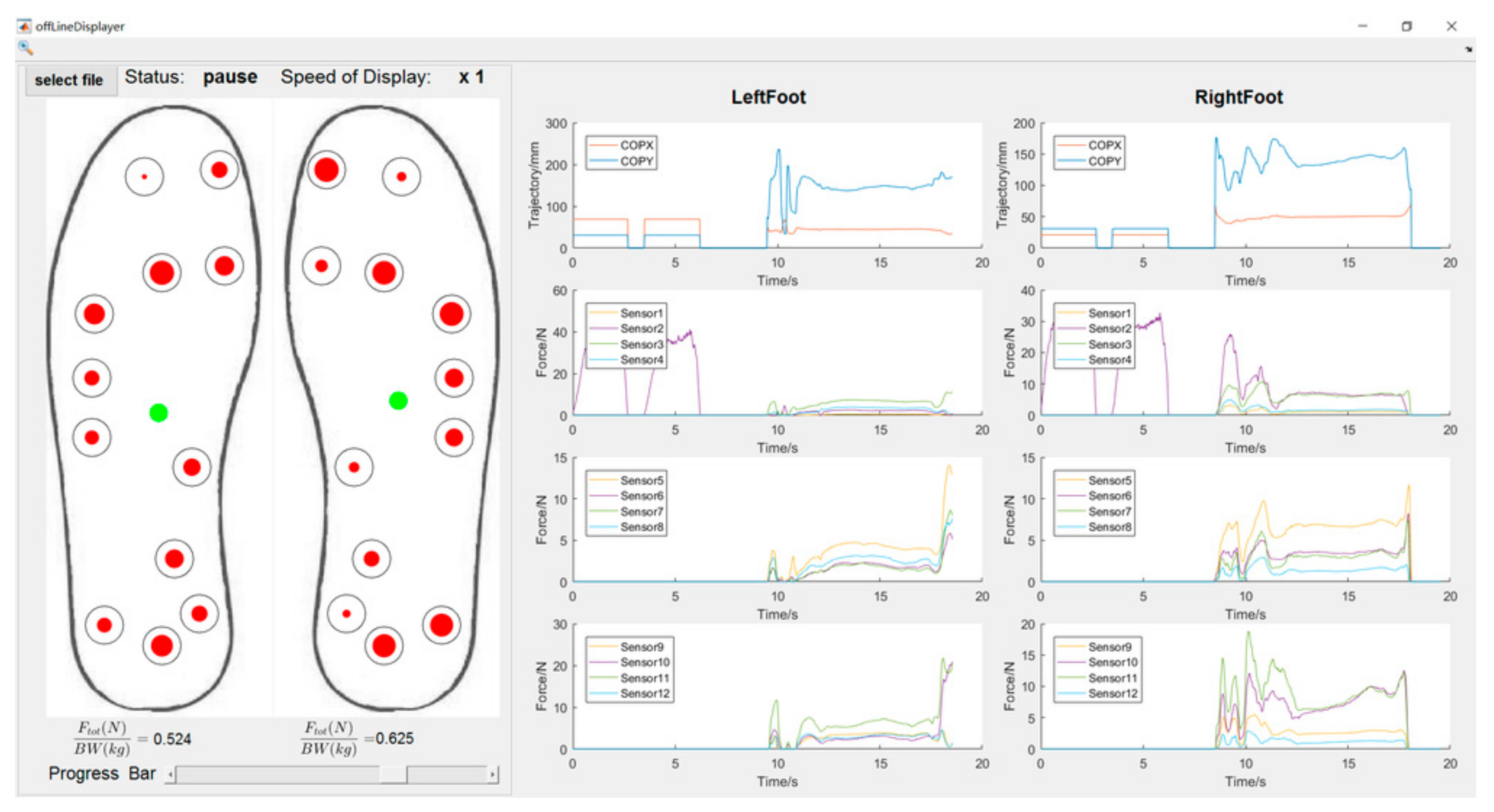 Sensors | Free Full-Text | Estimation of Foot Plantar Center of ...