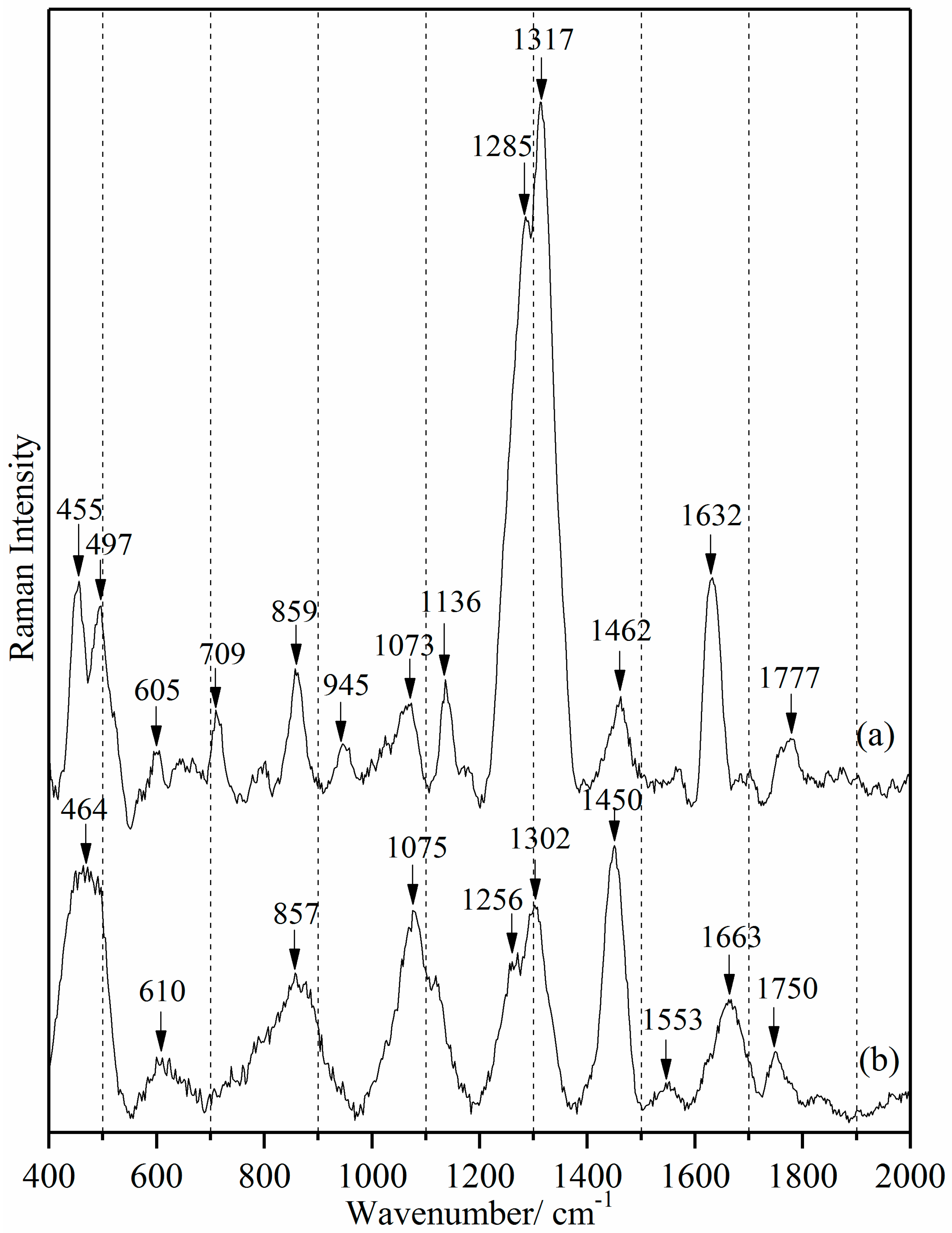 Sensors 18 00424 g002