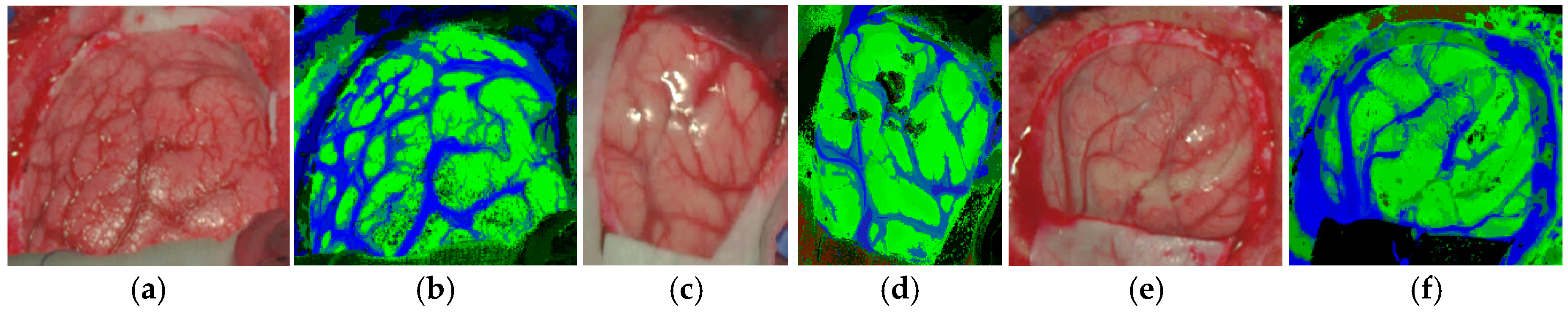 Sensors 18 00430 g009