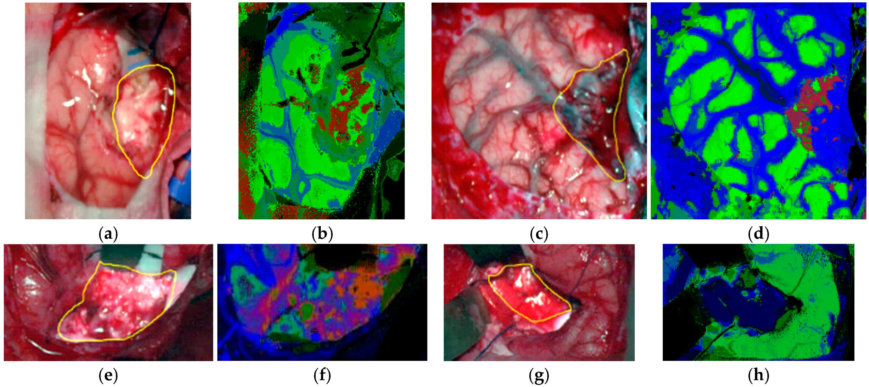 Sensors 18 00430 g010
