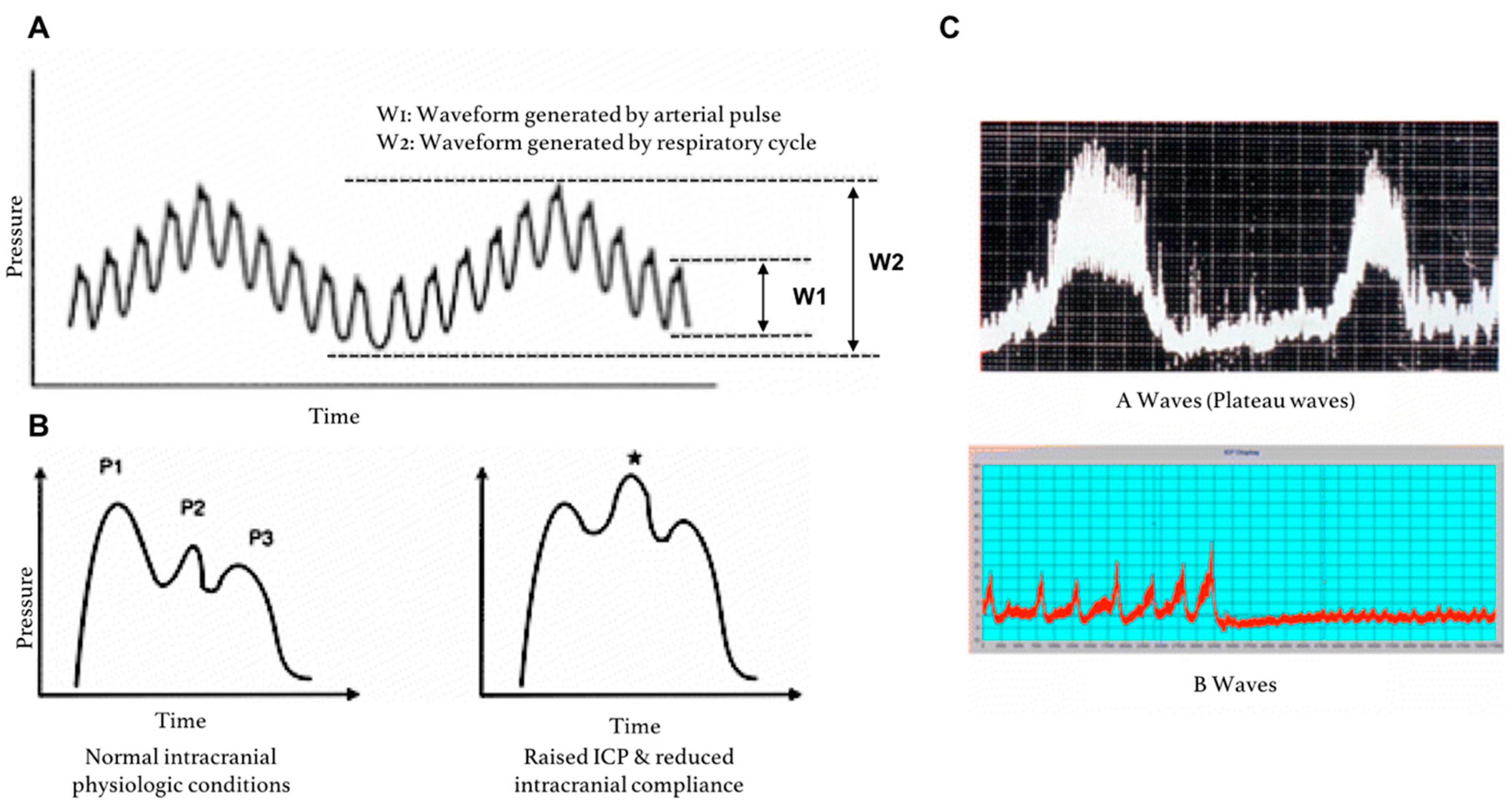 Sensors 18 00465 g005