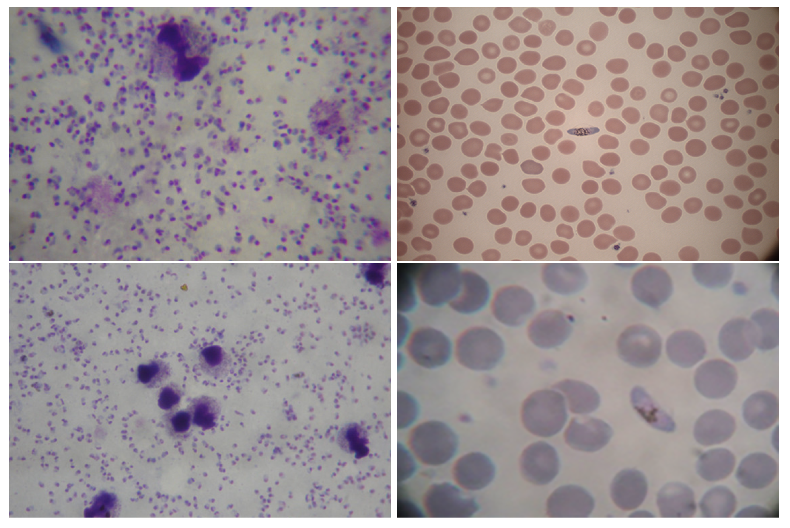 Image enhancement and segmentation using dark stretching technique for  Plasmodium Falciparum for thick blood smear