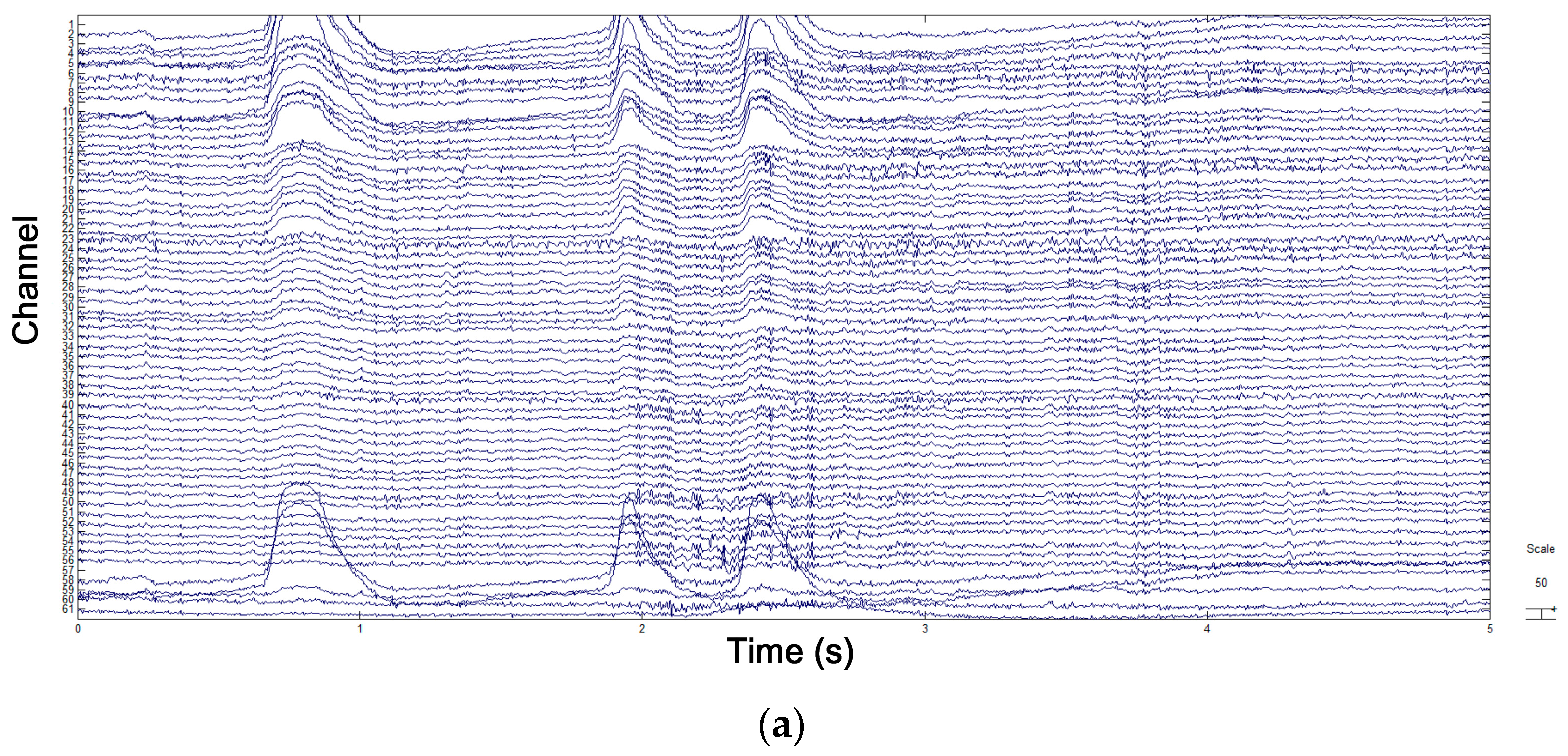 Sensors 18 00841 g006a 550