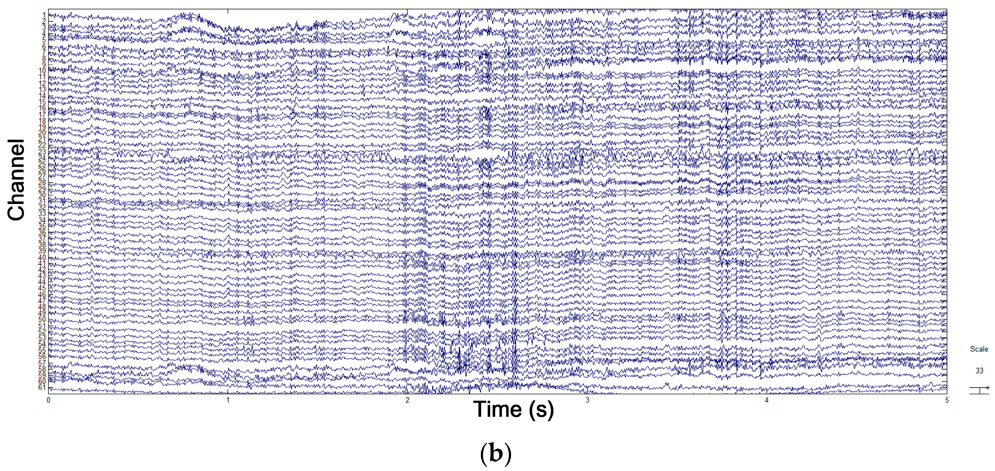 Sensors 18 00841 g006b 550