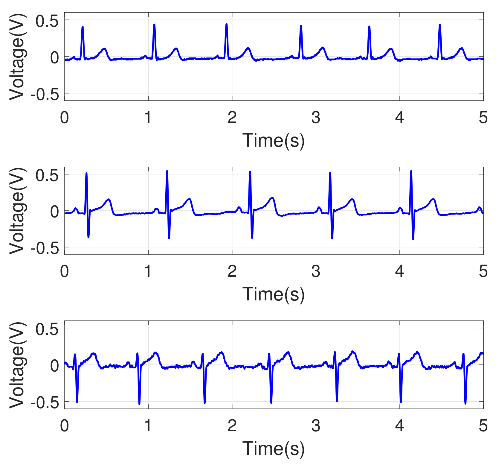 Sensors 18 01005 g004 Sensors 18 01005 g004