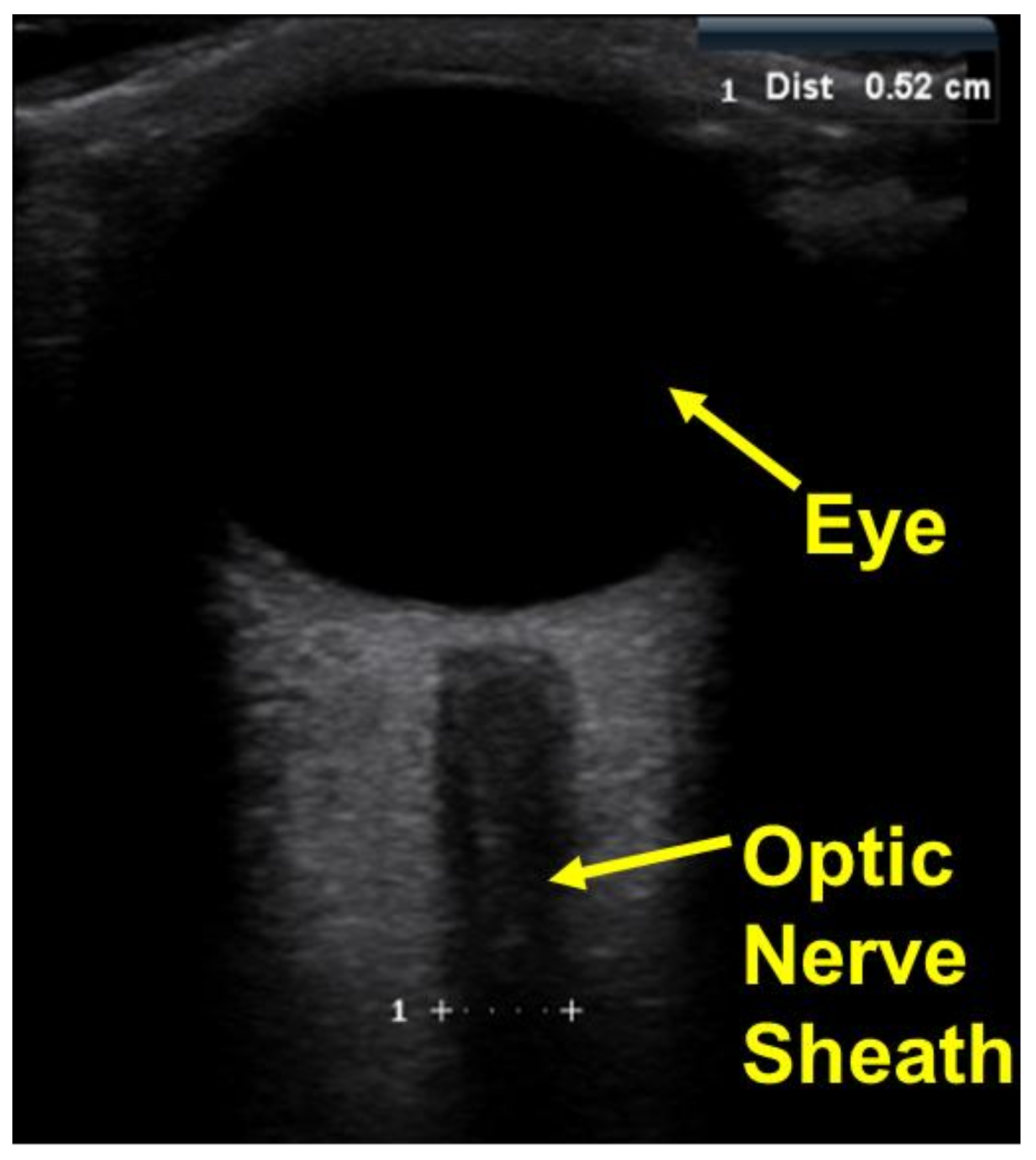 Sensors 18 01022 g010