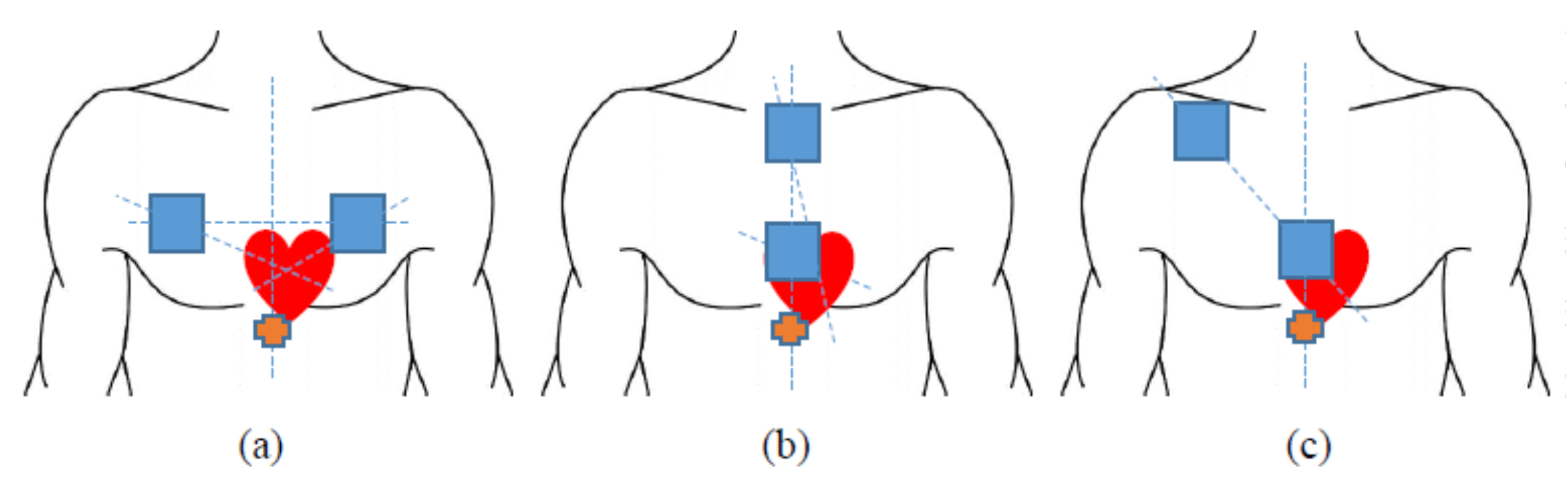 Sensors 18 01067 g003 550