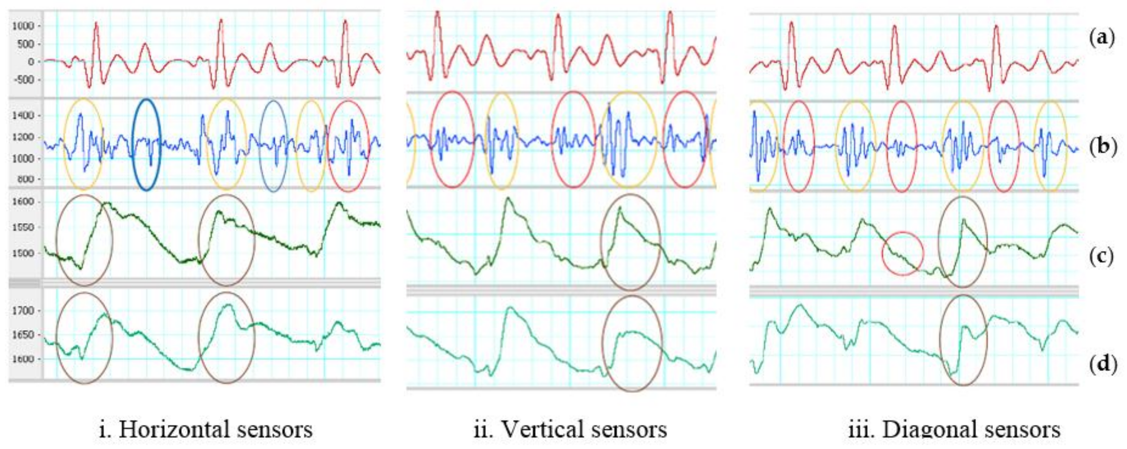 Sensors 18 01067 g007 550