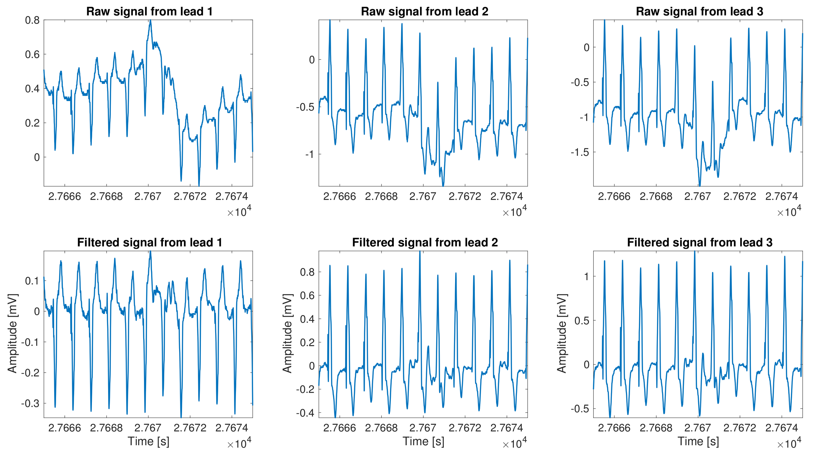 Sensors 18 01387 g002
