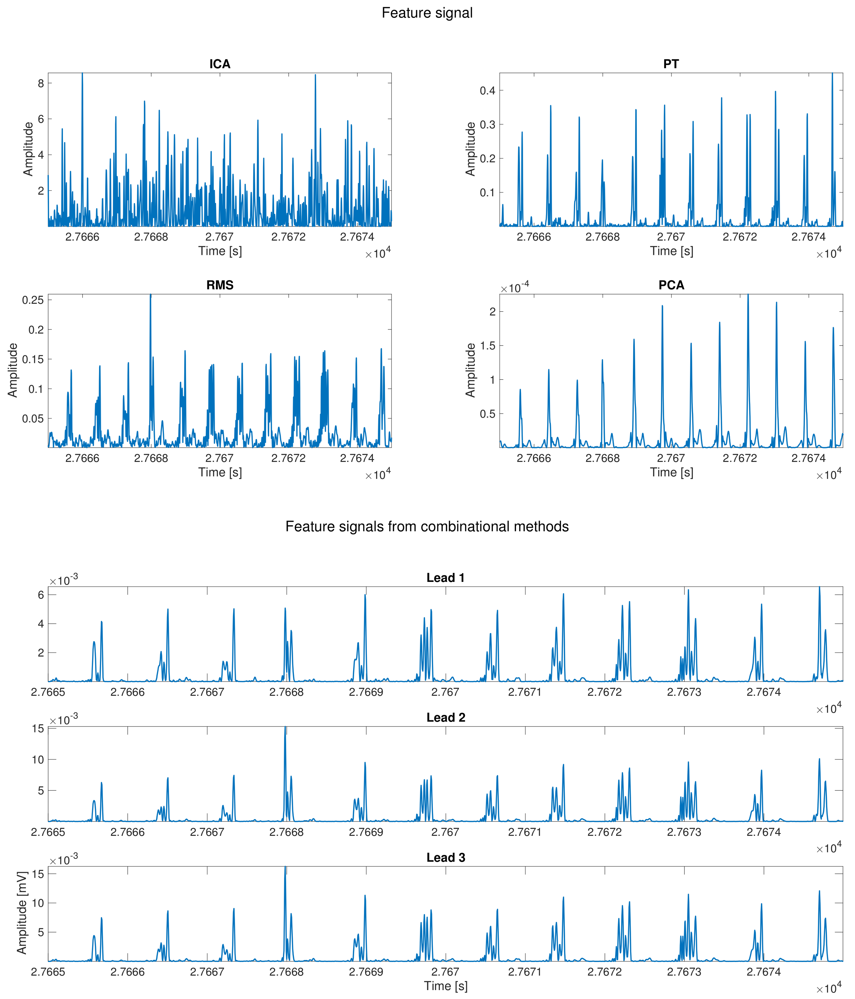 Sensors 18 01387 g003