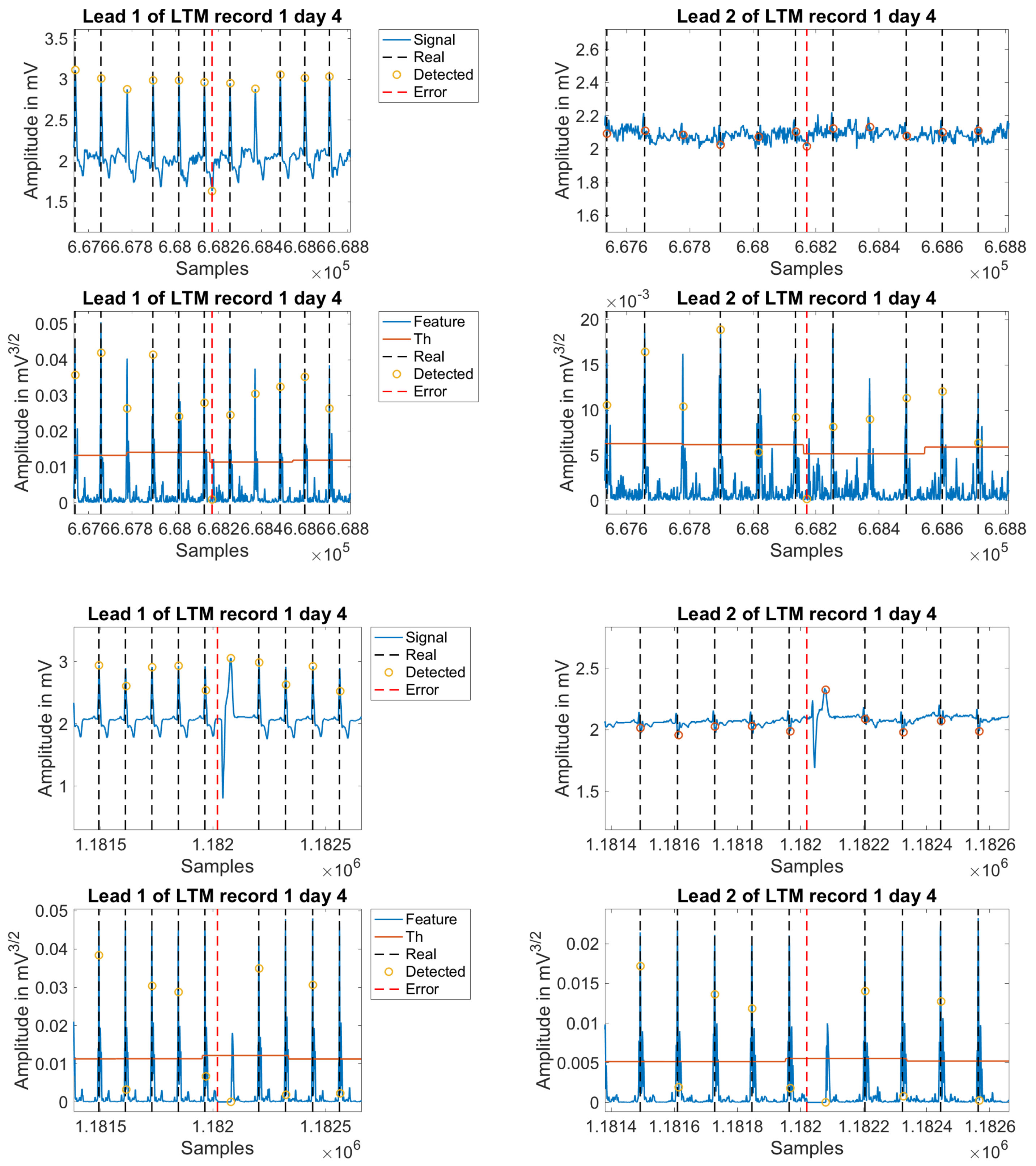 Sensors 18 01387 g010