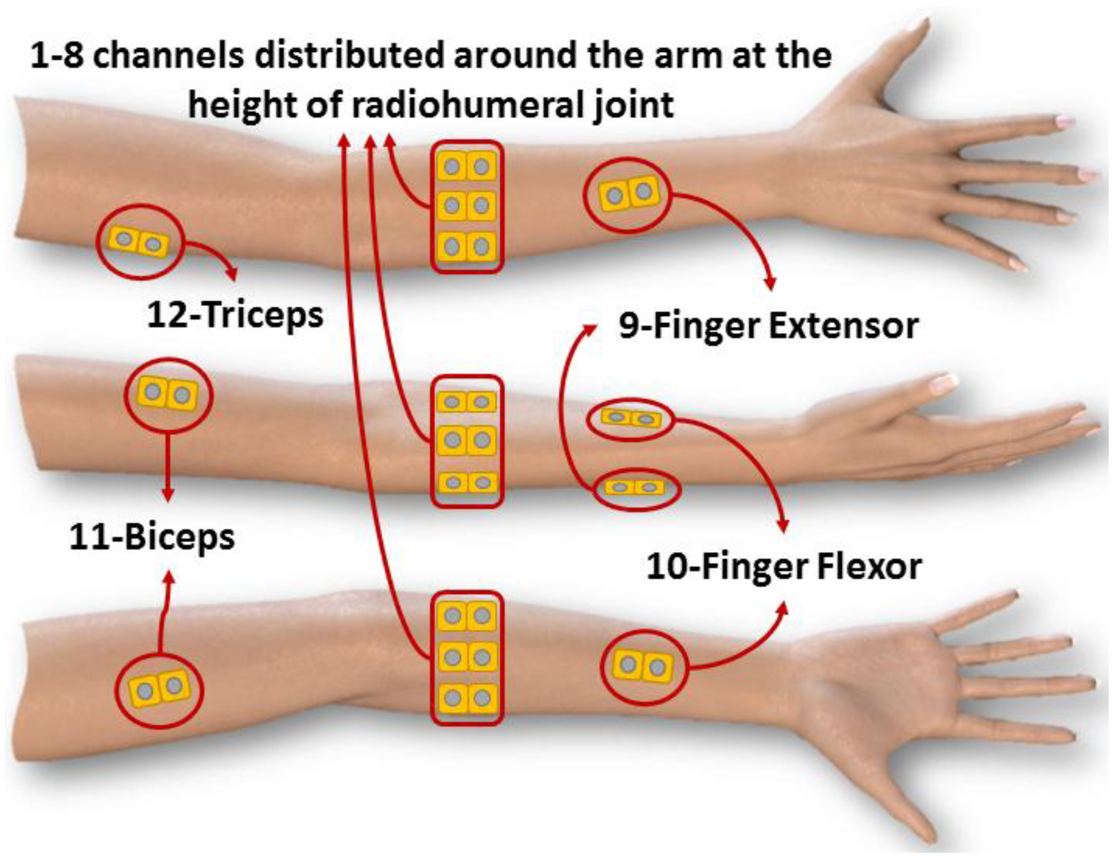 Sensors 18 01388 g002