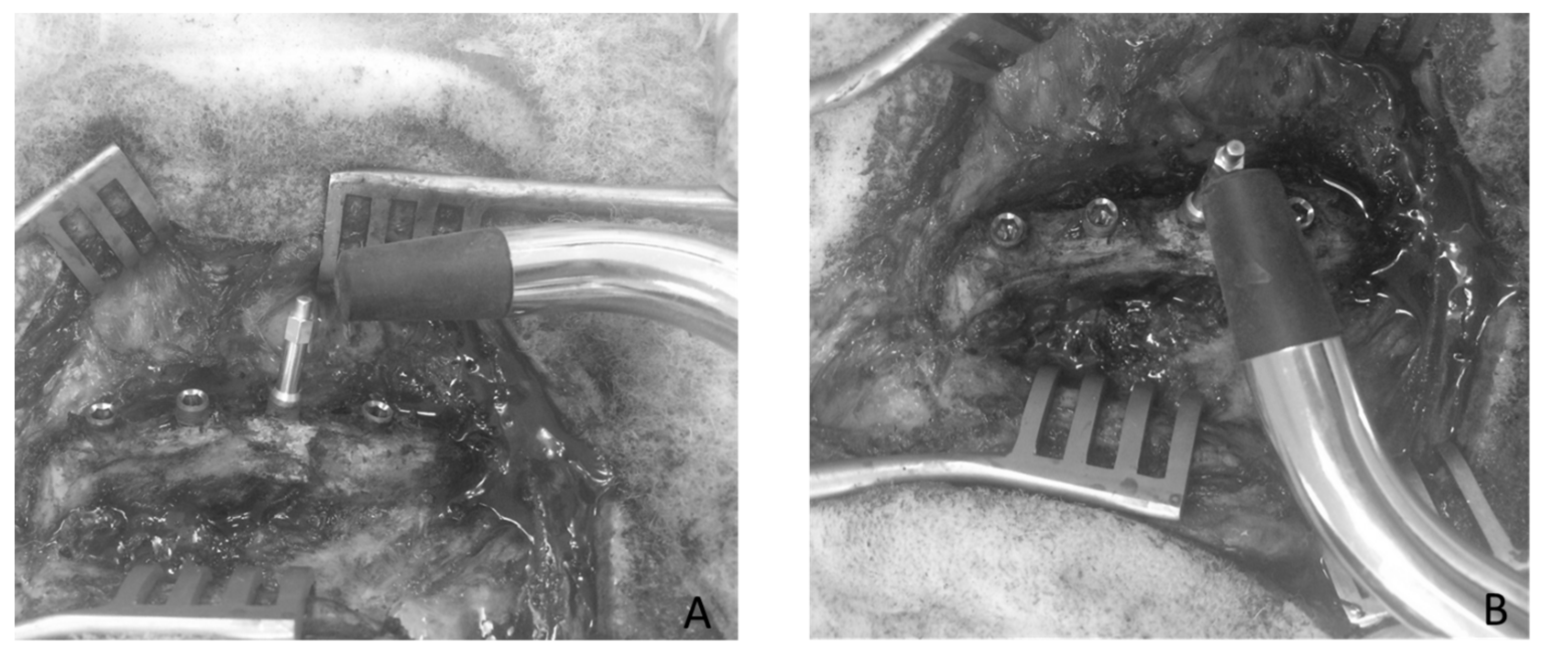 Sensors 18 01397 g004 Sensors 18 01397 g004
