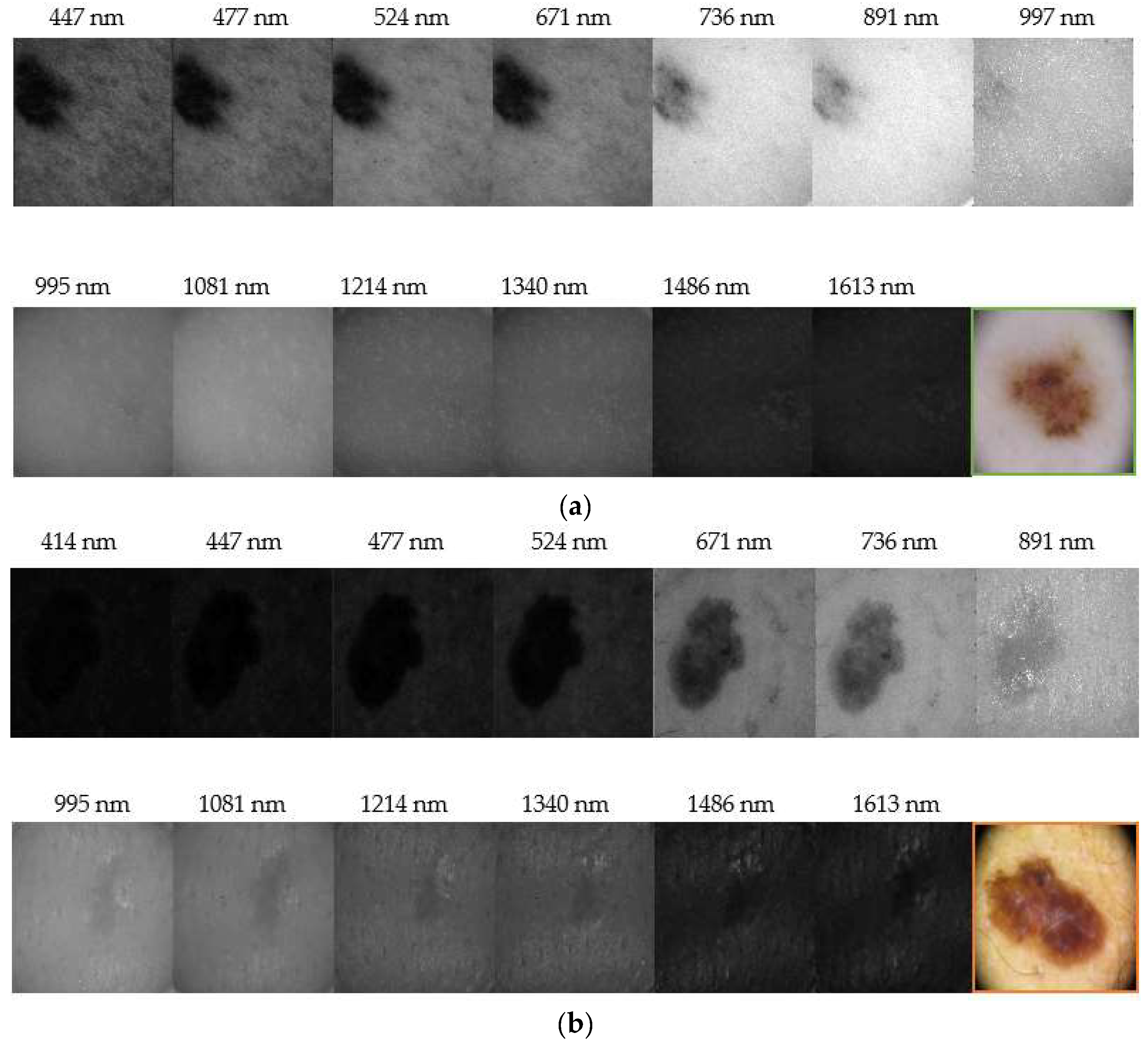 Sensors 18 01441 g006