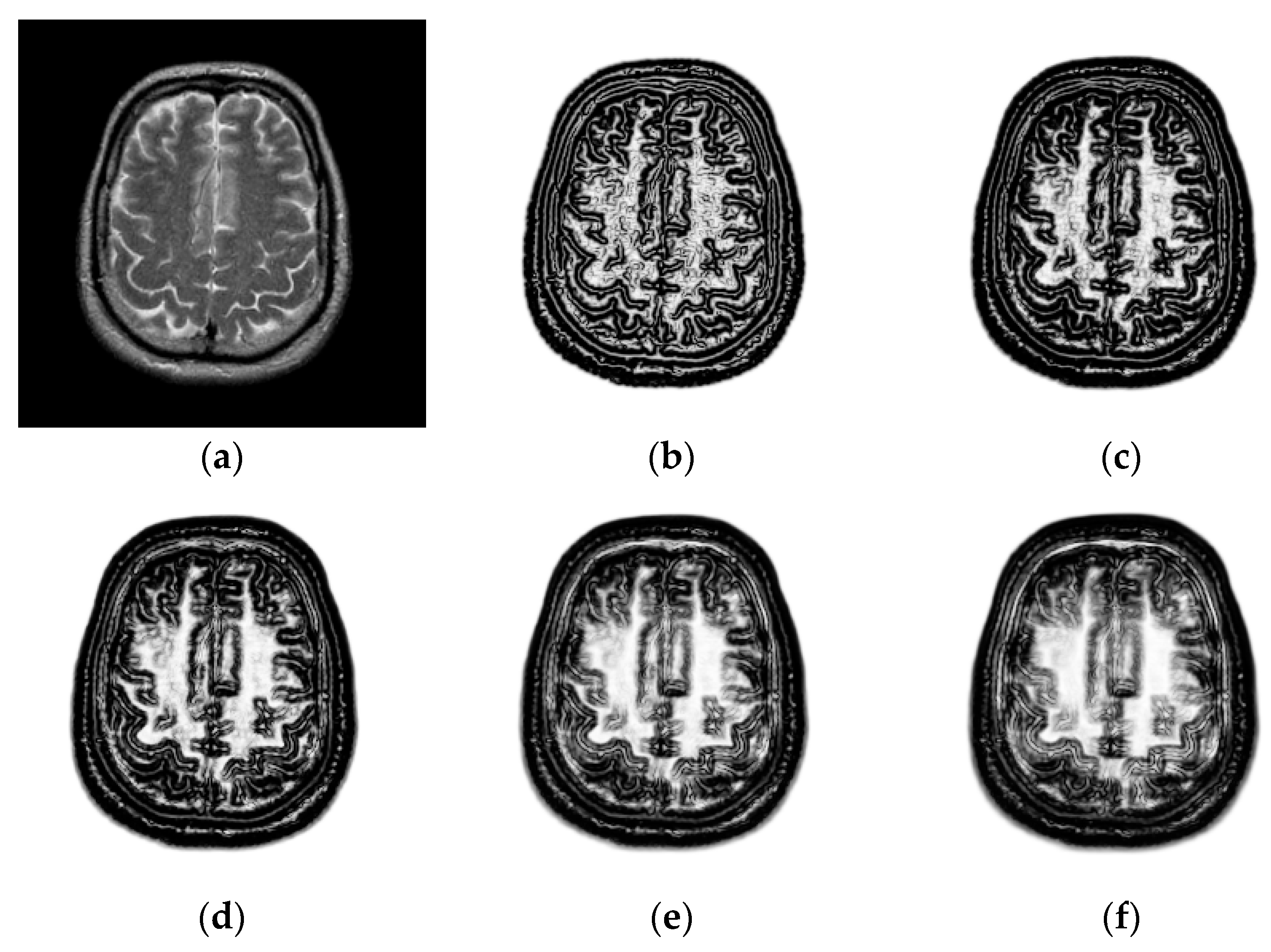Sensors 18 01477 g004
