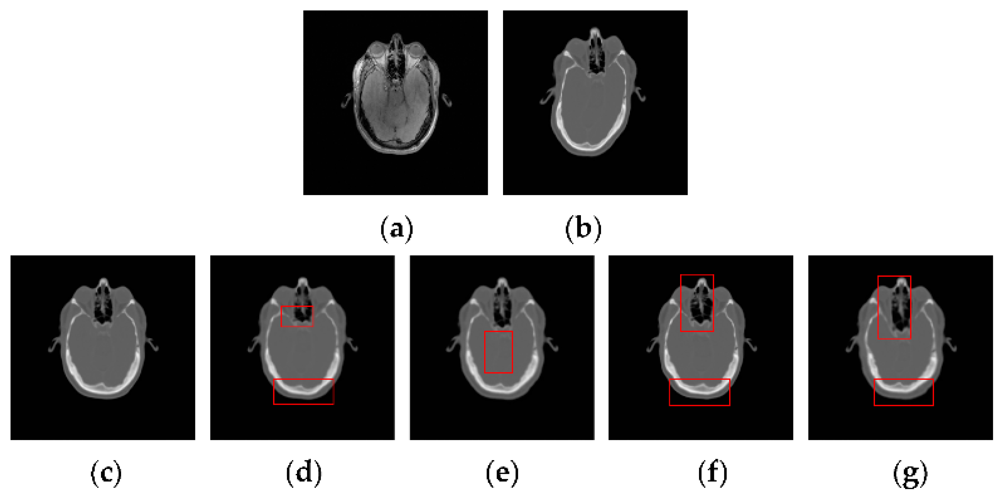 Sensors 18 01477 g015