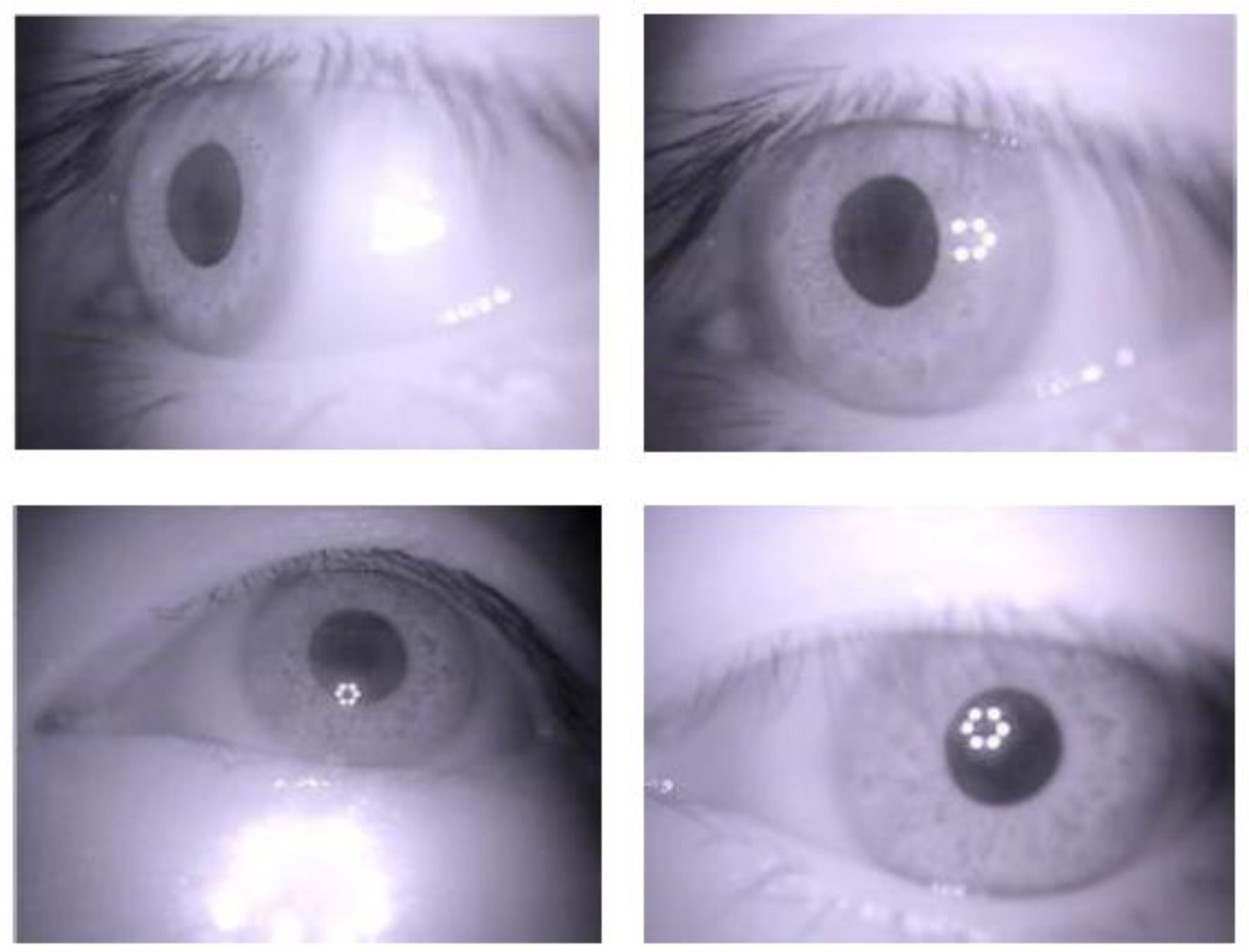 Sensors 18 01626 g010