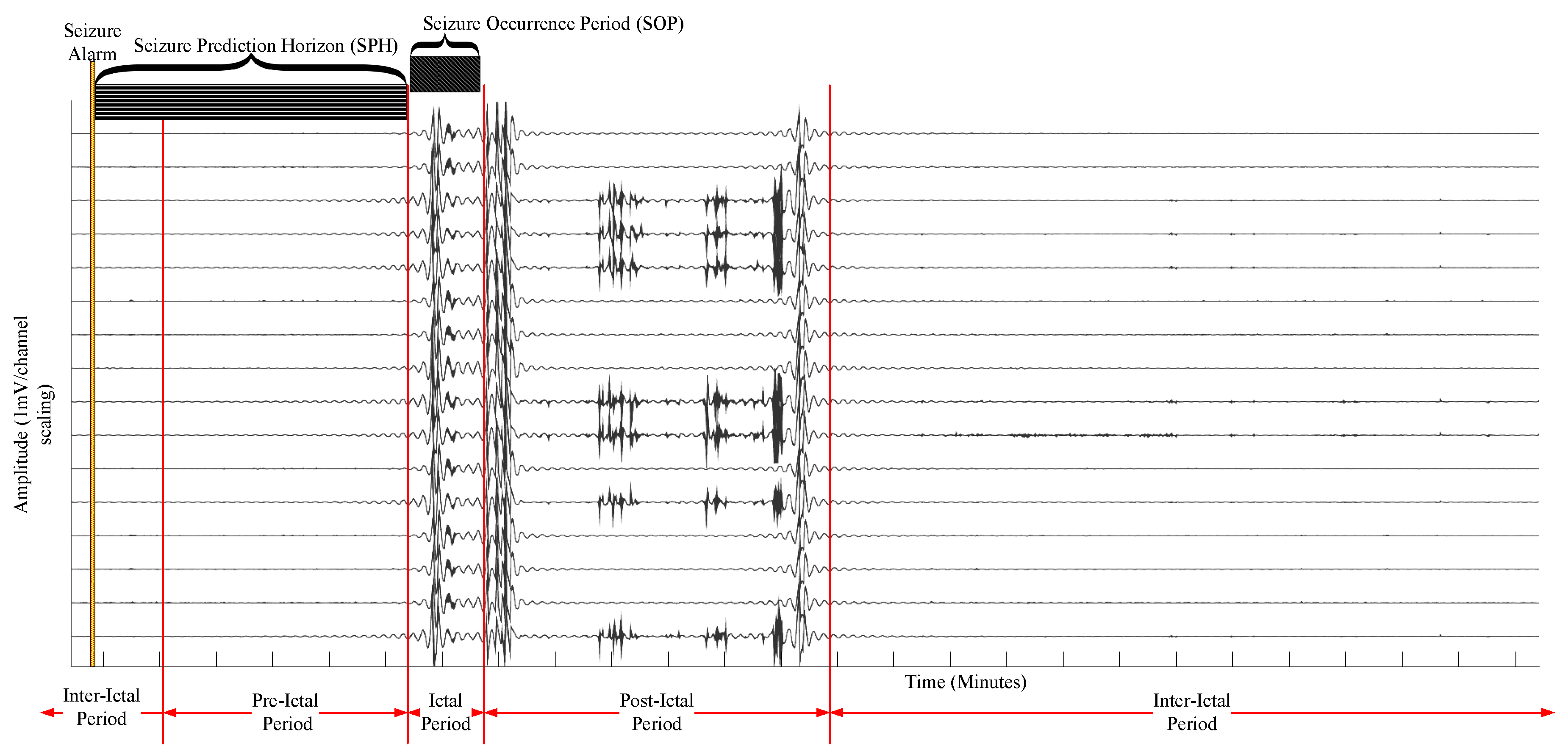 Sensors Free Full Text Towards An Online Seizure Advisory