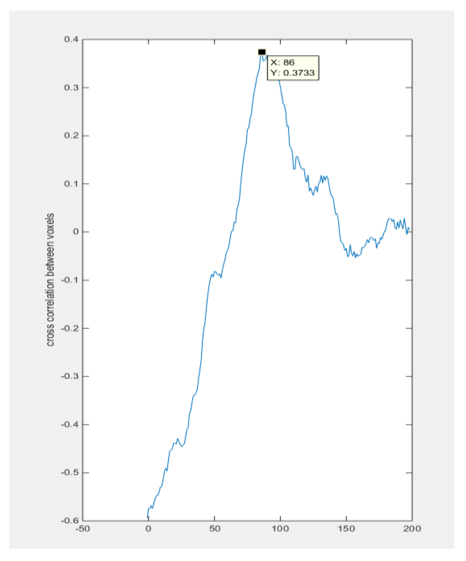 Sensors 18 01704 g016