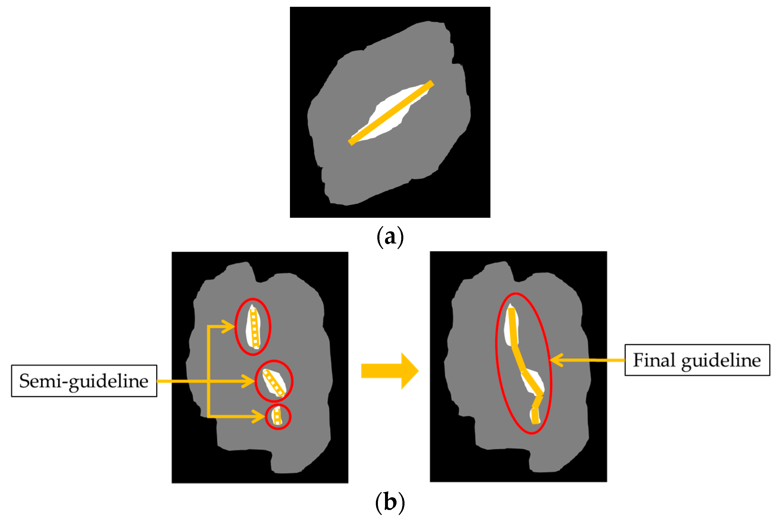 Sensors 18 01746 g011