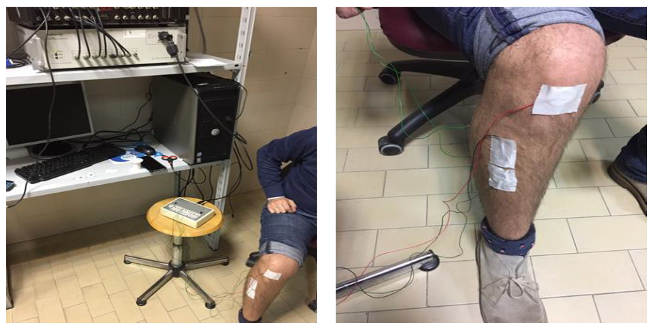 Sensors 18 01748 g007 550