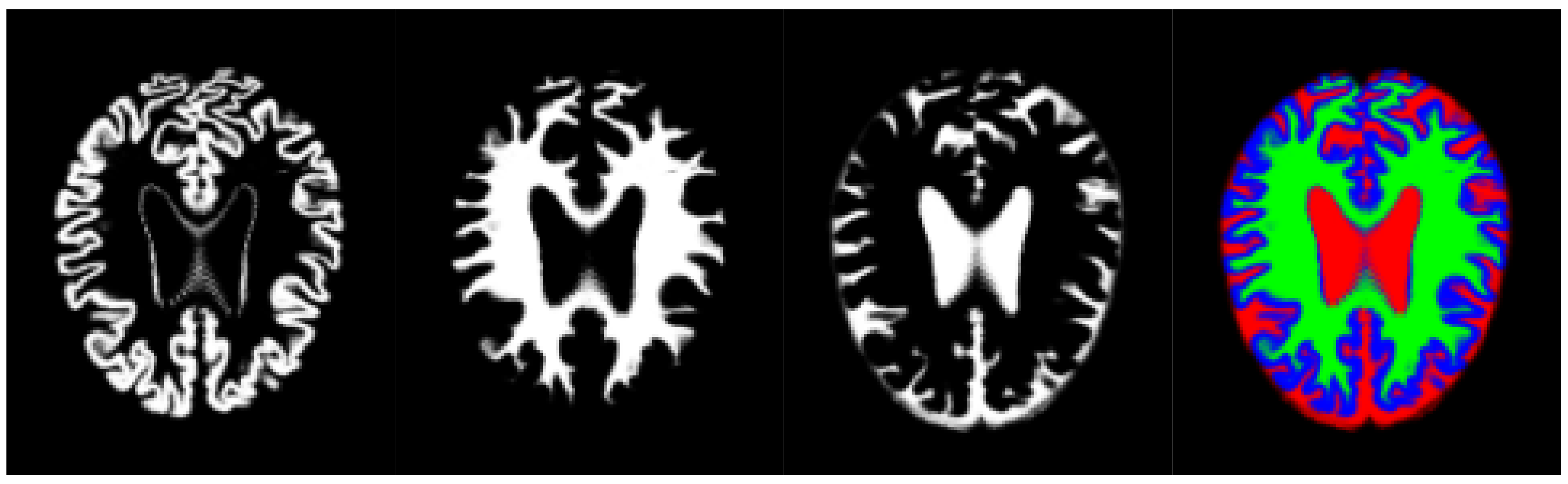 Sensors 18 01752 g003