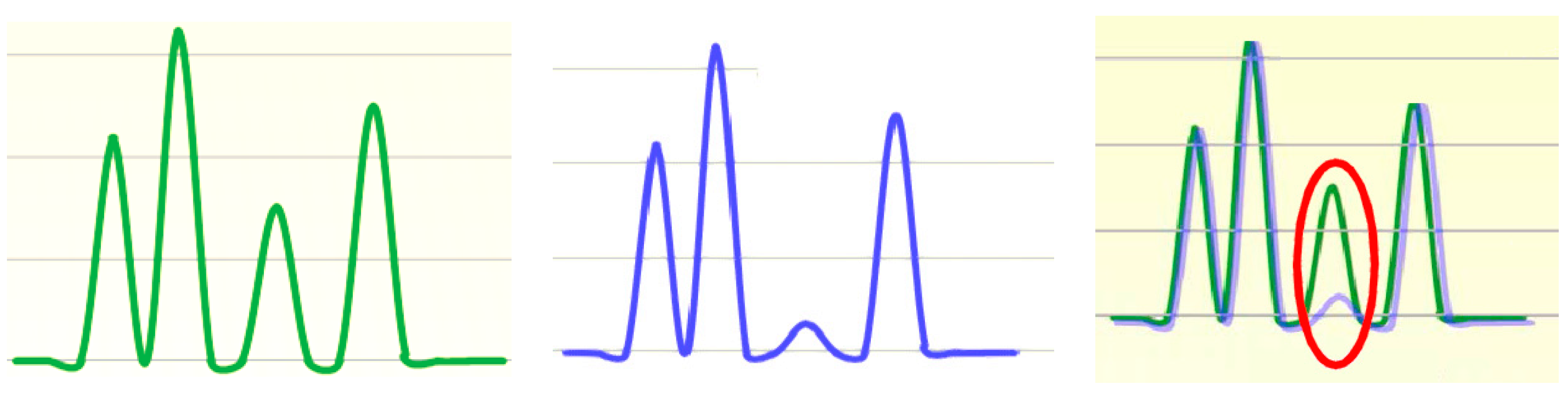 Sensors 18 01810 g008