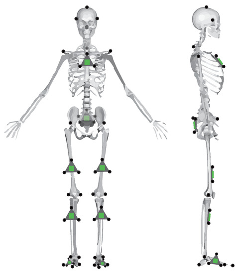 Robust estimation of vertical symmetry axis models via joint