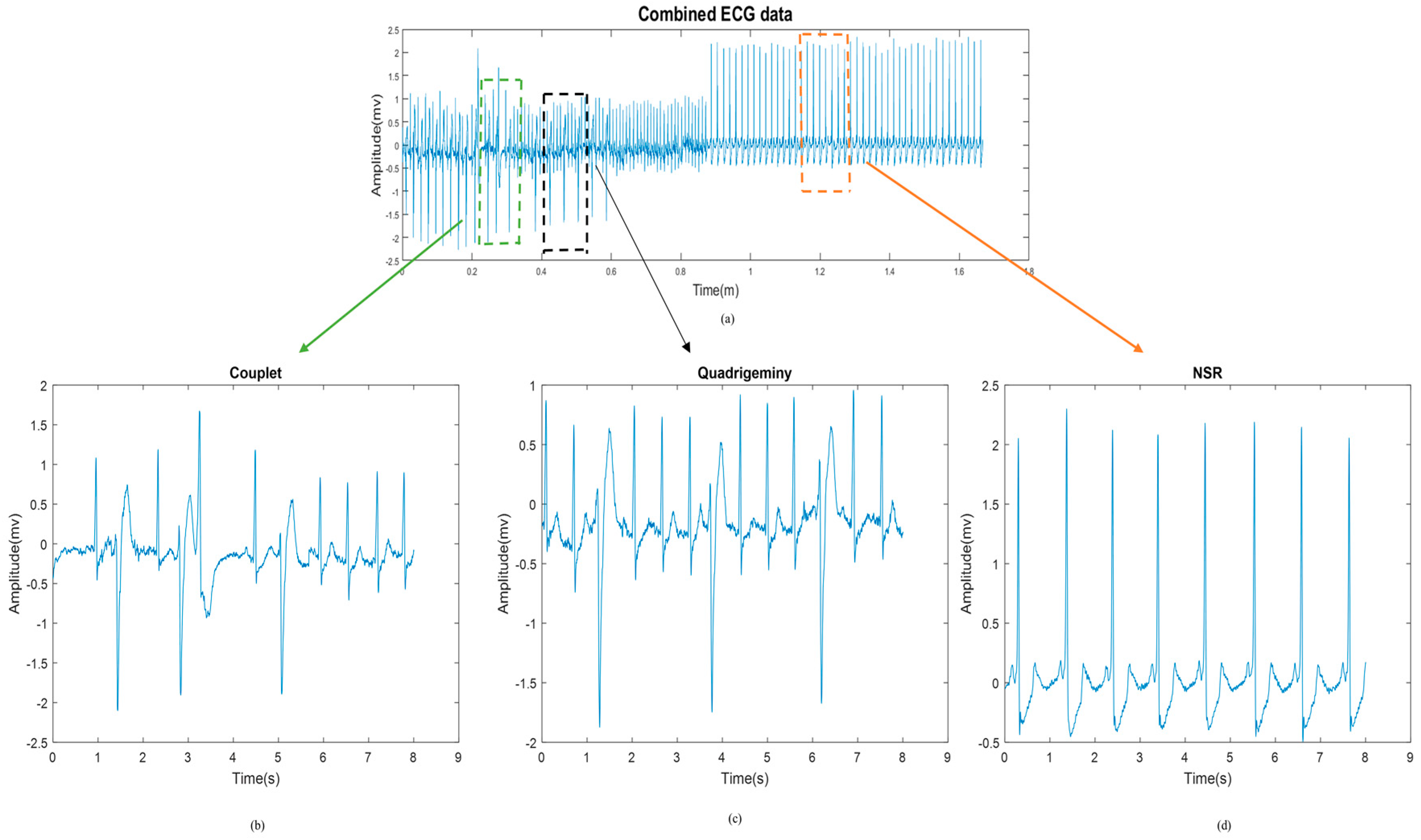 Sensors 18 02090 g014