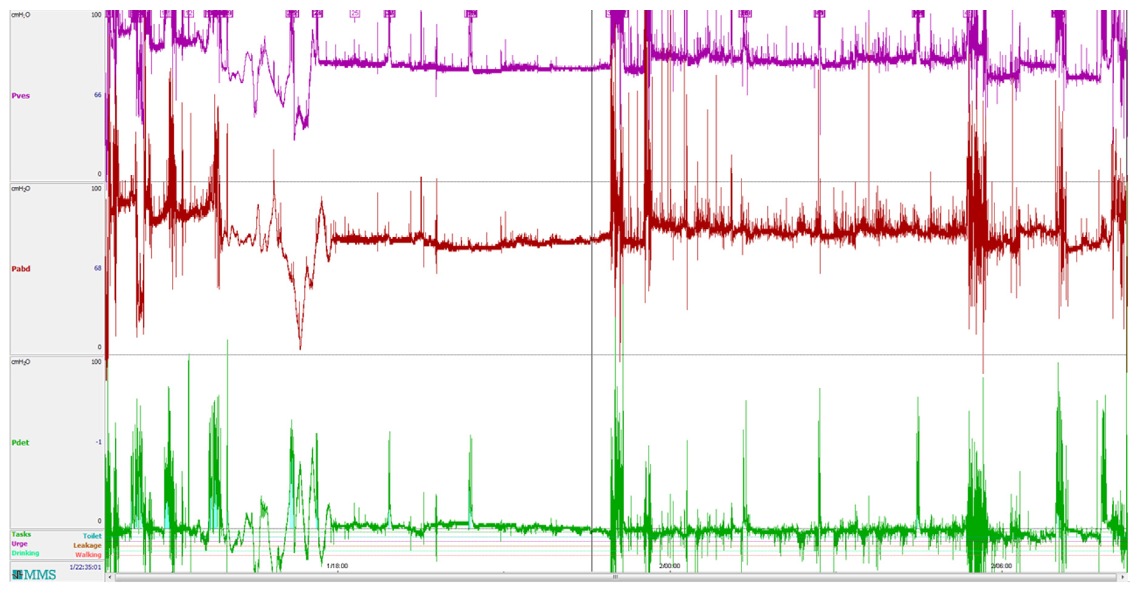 Sensors 18 02128 g009 550
