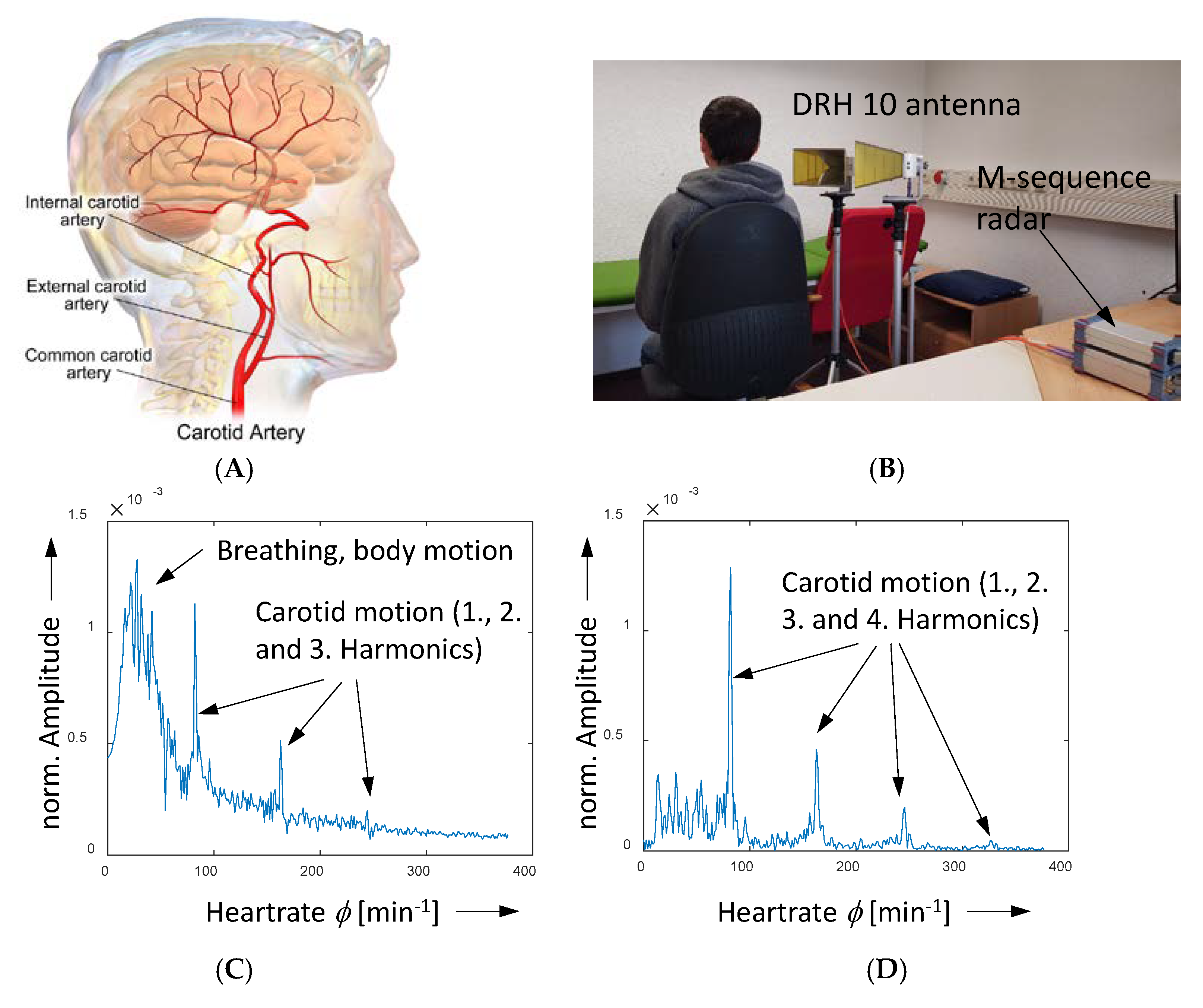 Sensors 18 02136 g020