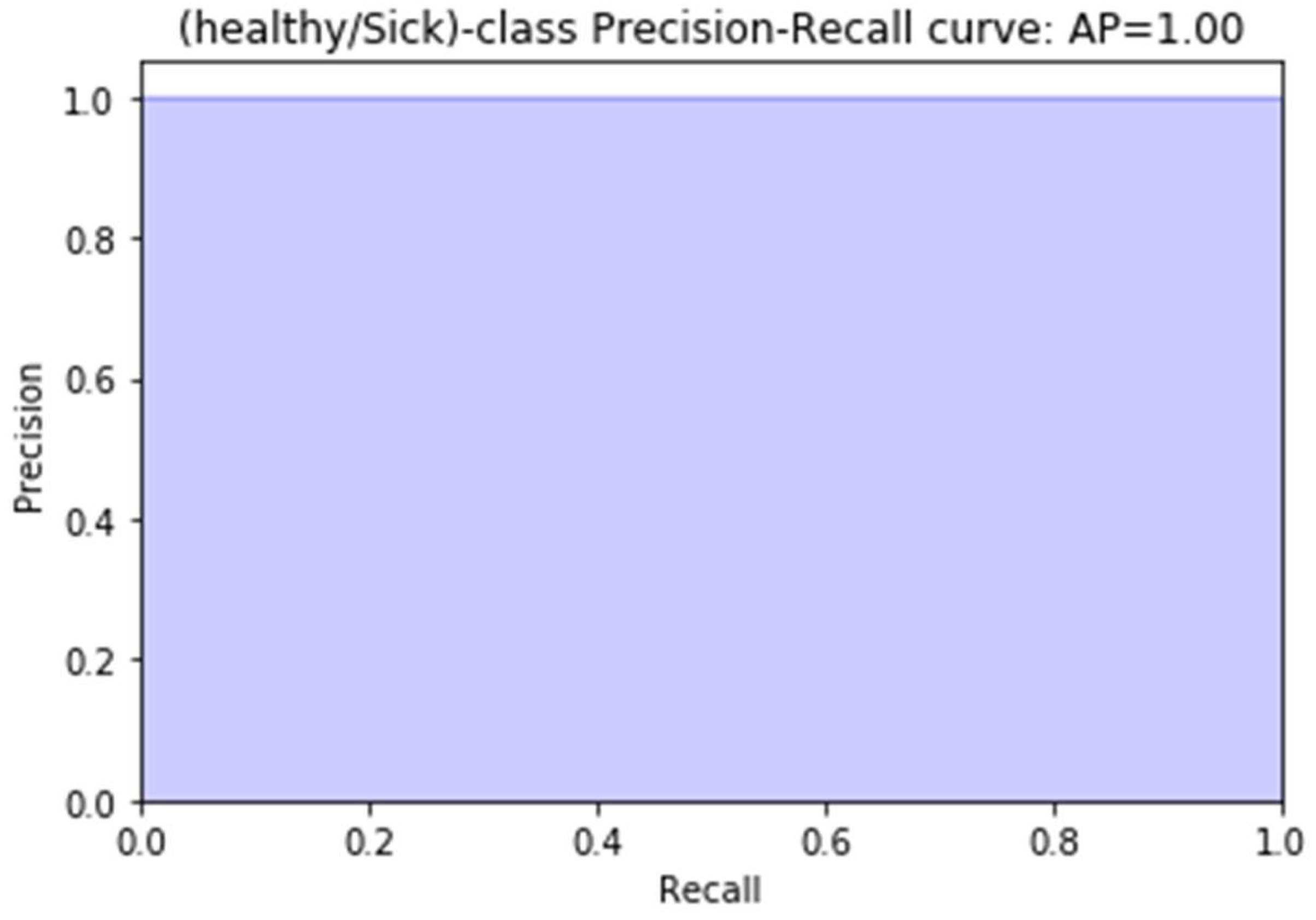 Sensors | Free Full-Text | Breast Cancer Detection Using Infrared ...