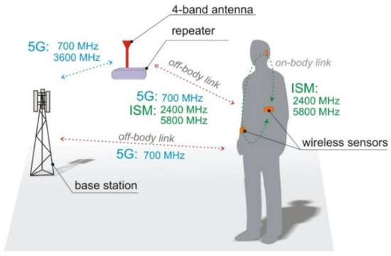 Kセット Right Side Foot Peg Pedal Mounting Bracket For Kawasaki