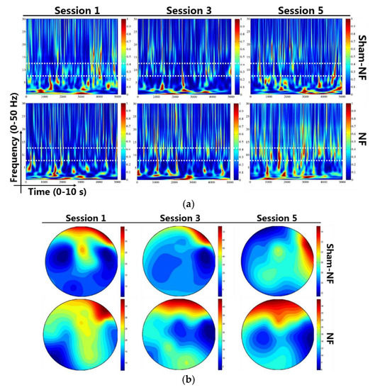 Effects of an Integrated Neurofeedback System with Dry Electrodes: EEG ...