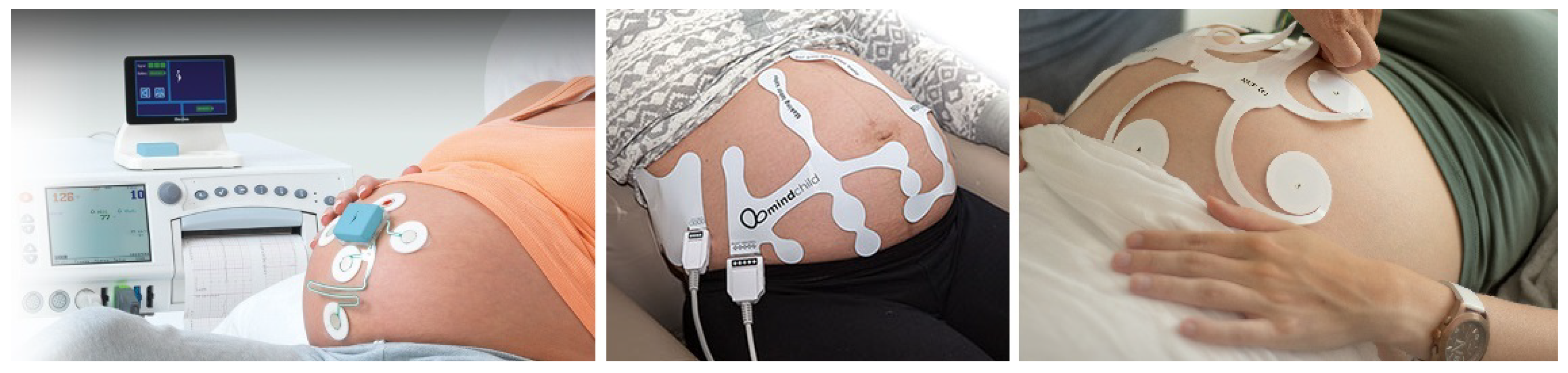 Sensors 18 03648 g001