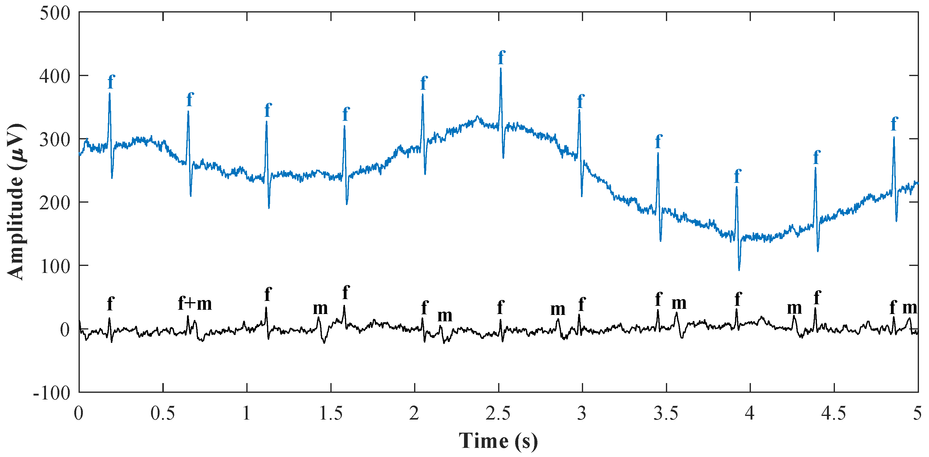 Sensors 18 03648 g005