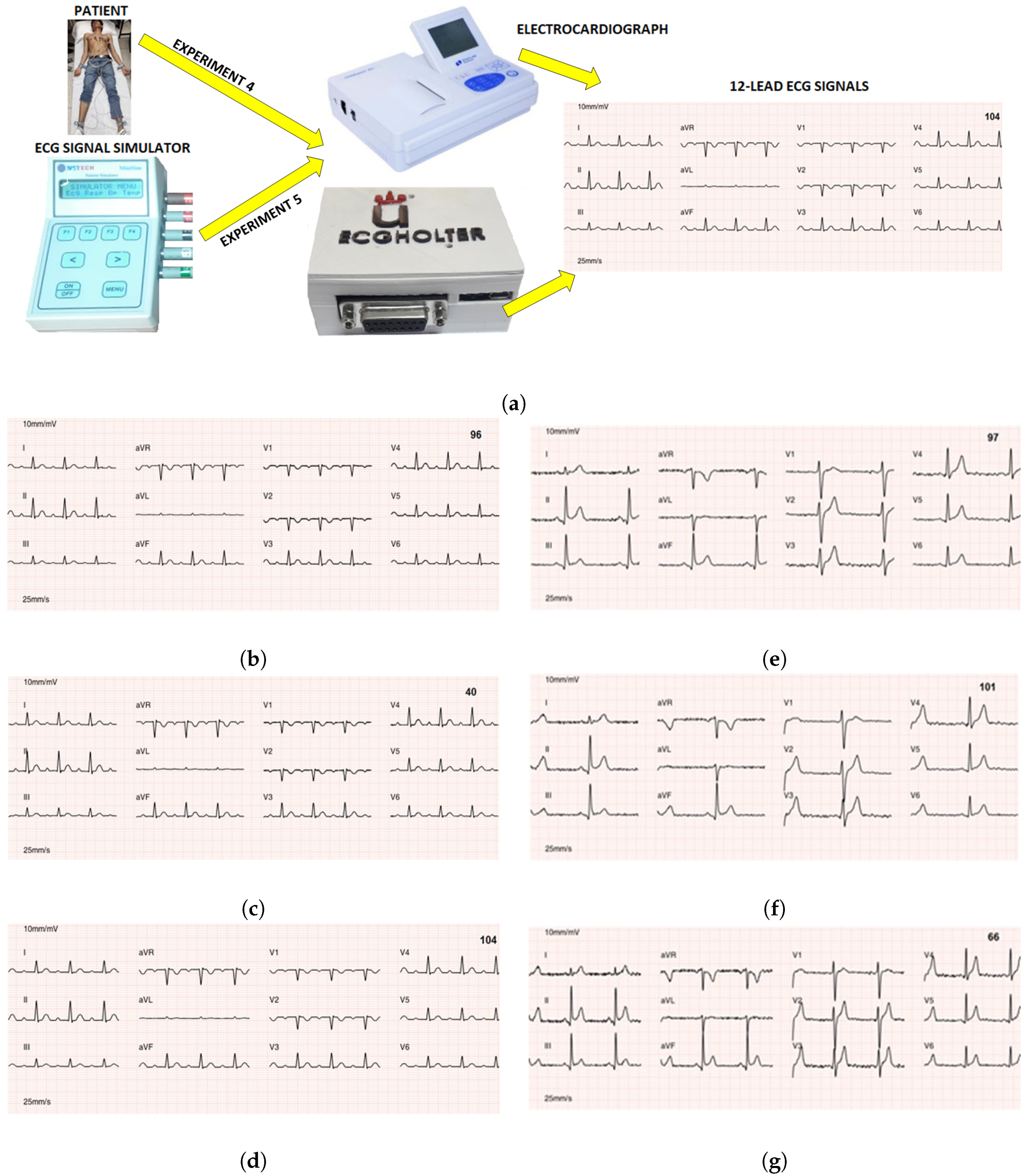 sensors free full text a flexible 12 lead holter device with normal paper scale voltage calibration for ecg graph paper