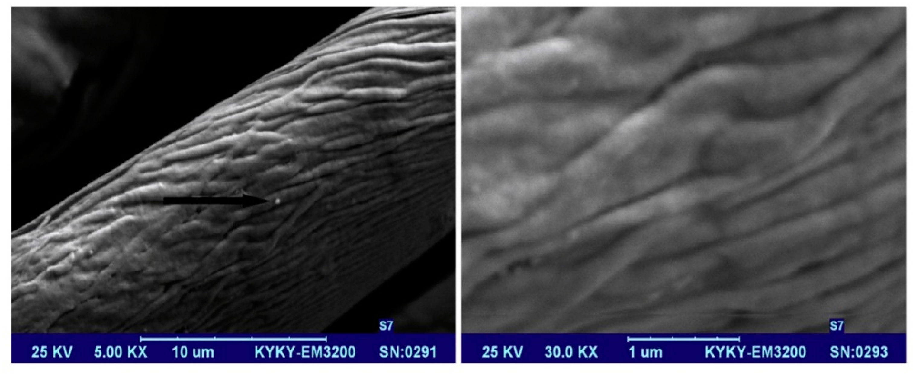 Sensors 18 03812 g013