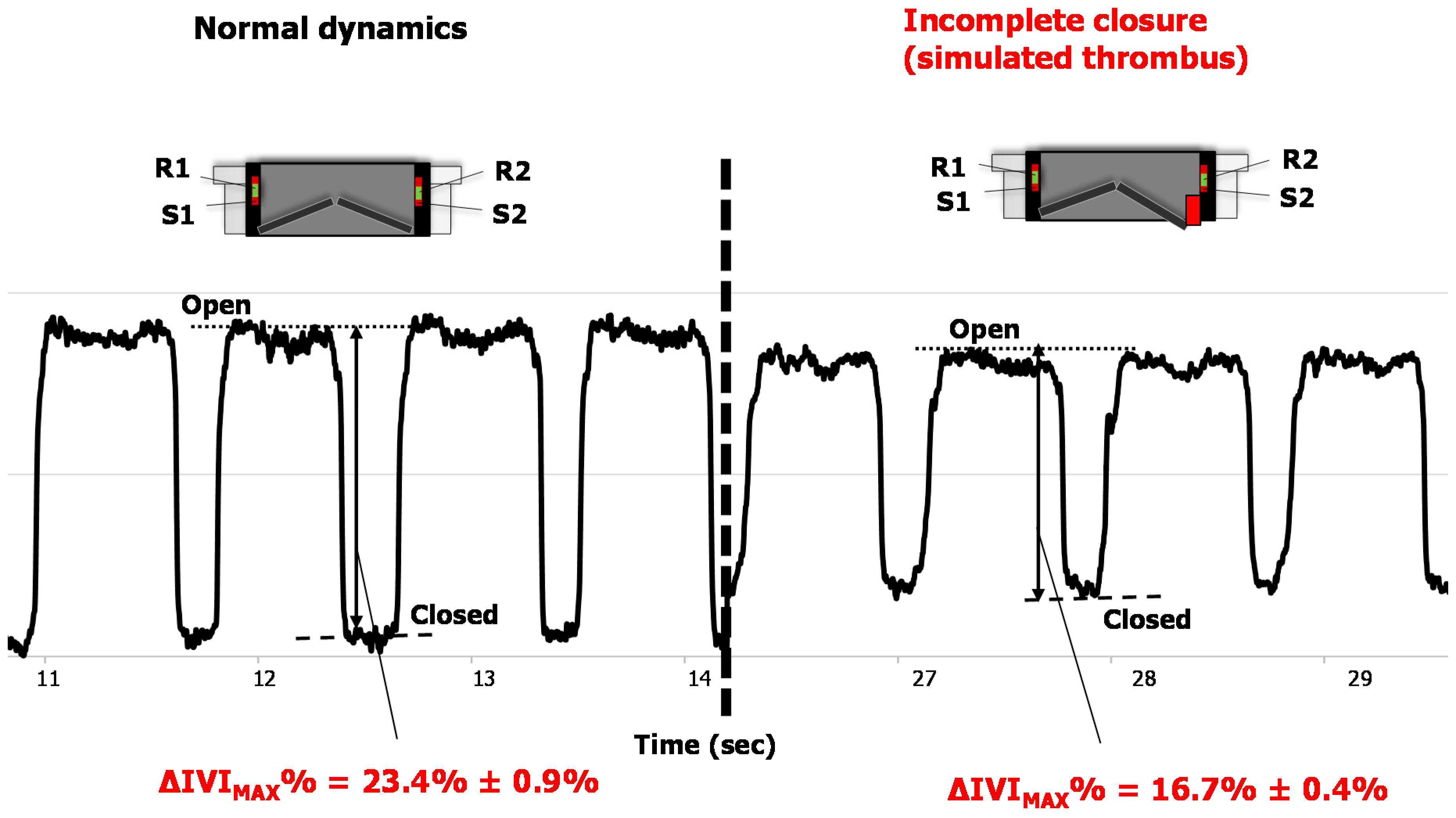 Sensors 18 03905 g006