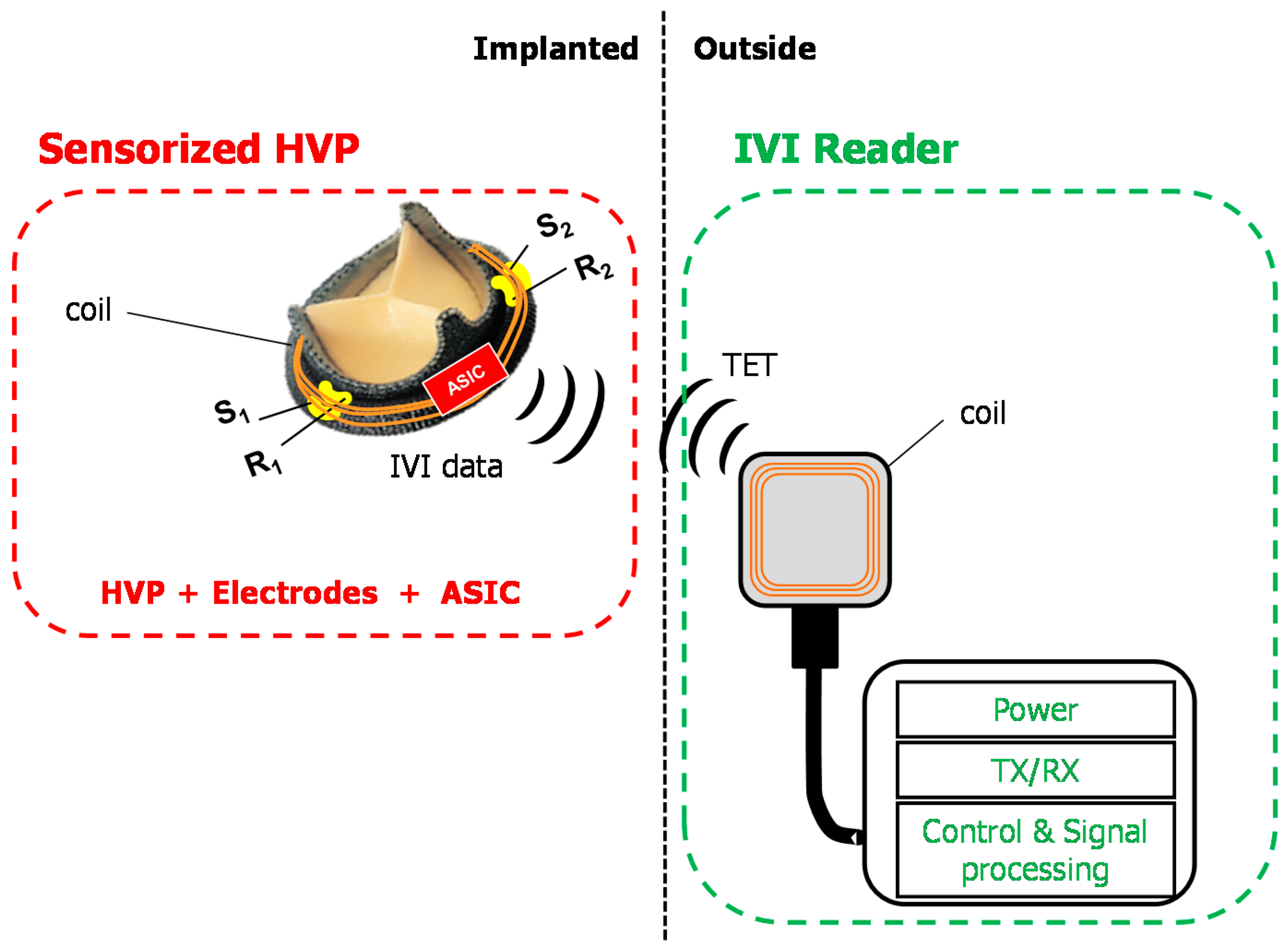 Sensors 18 03905 g007