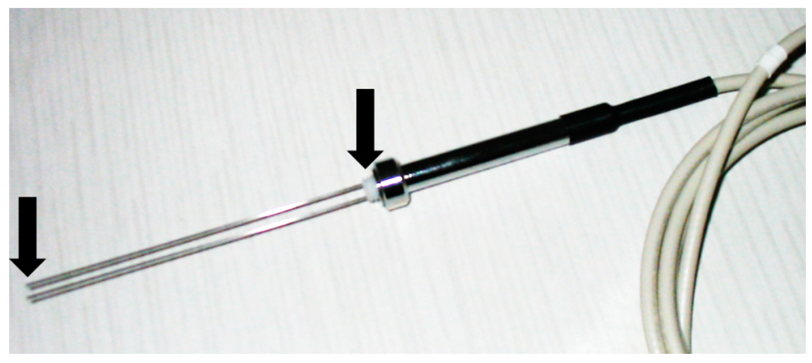 Sensors 18 03935 g001