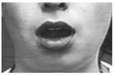 Sensors 18 03993 i014