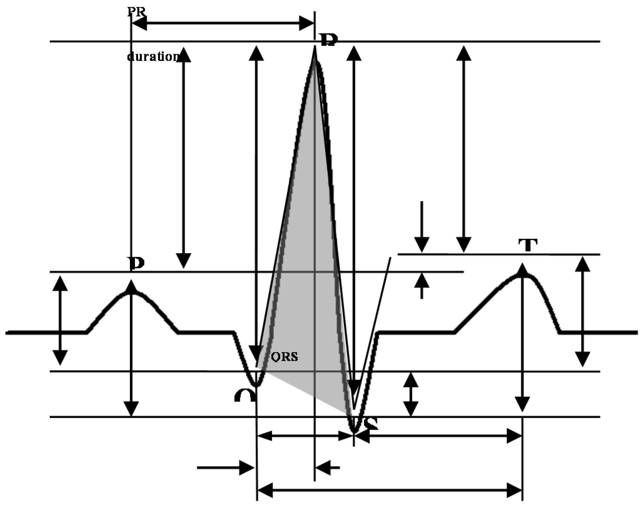 Sensors 18 04138 g011 550