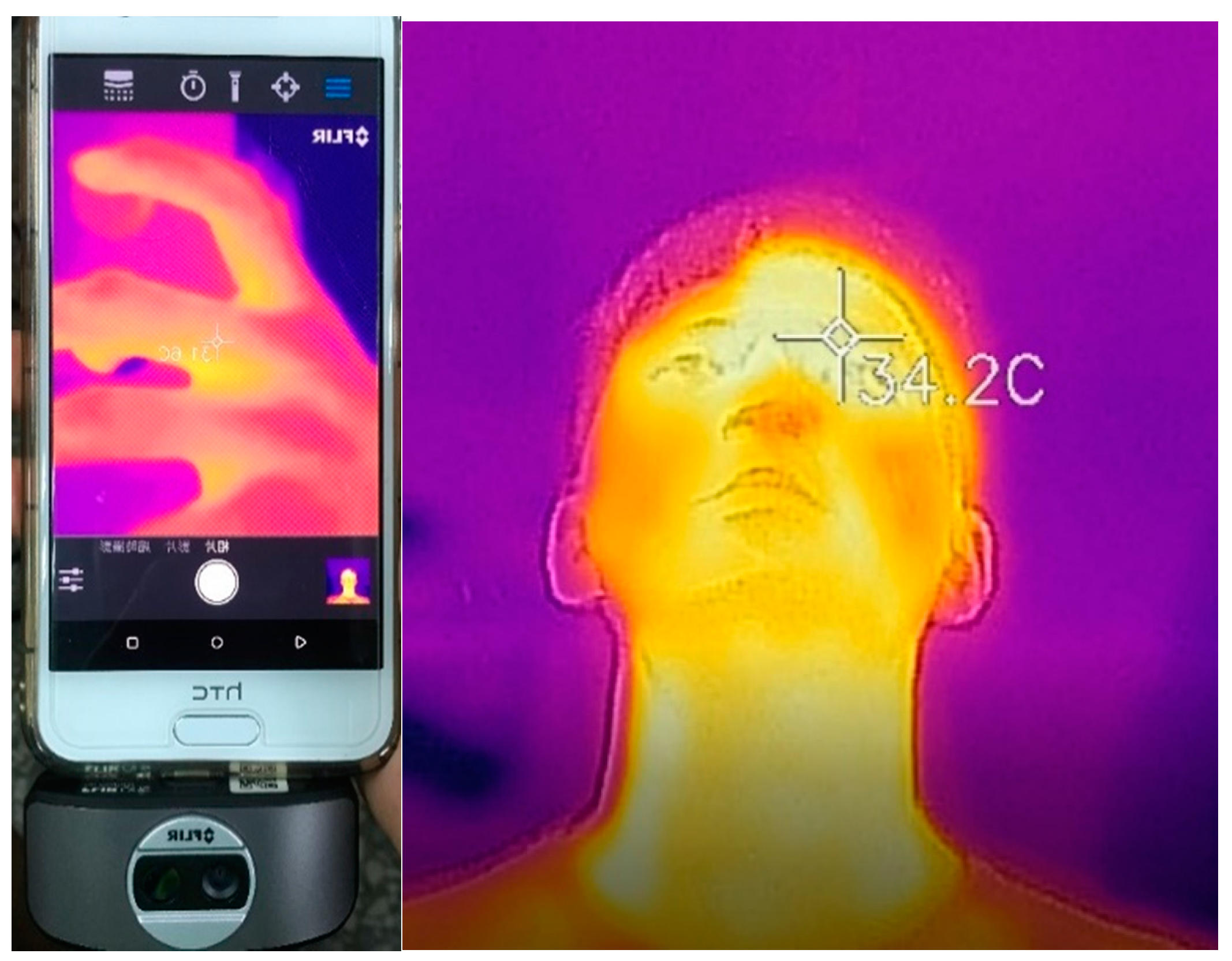 Sensors 18 04347 g007