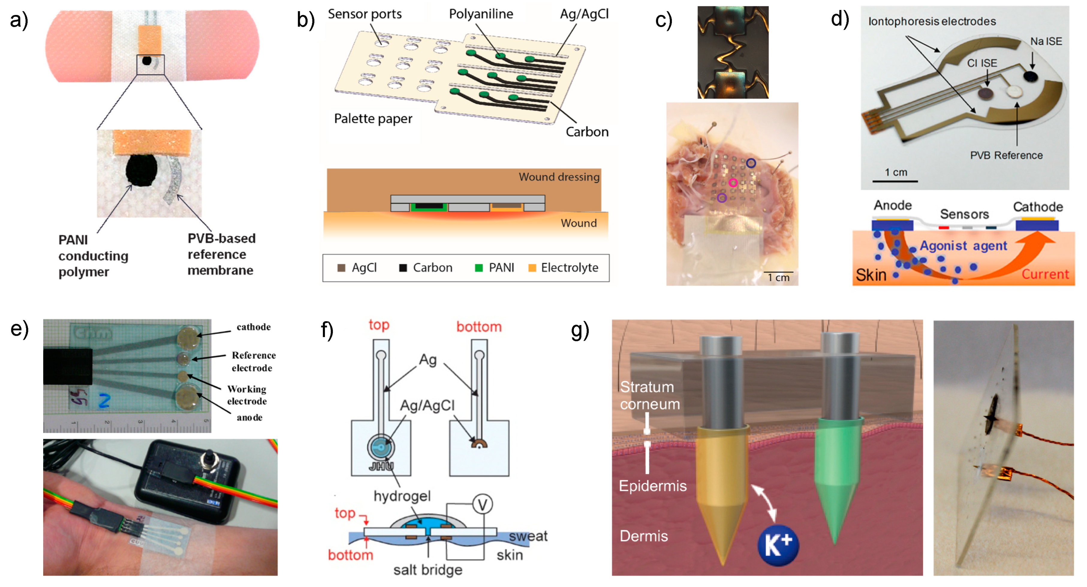 Sensors Free FullText Wearable Potentiometric Sensors for Medical