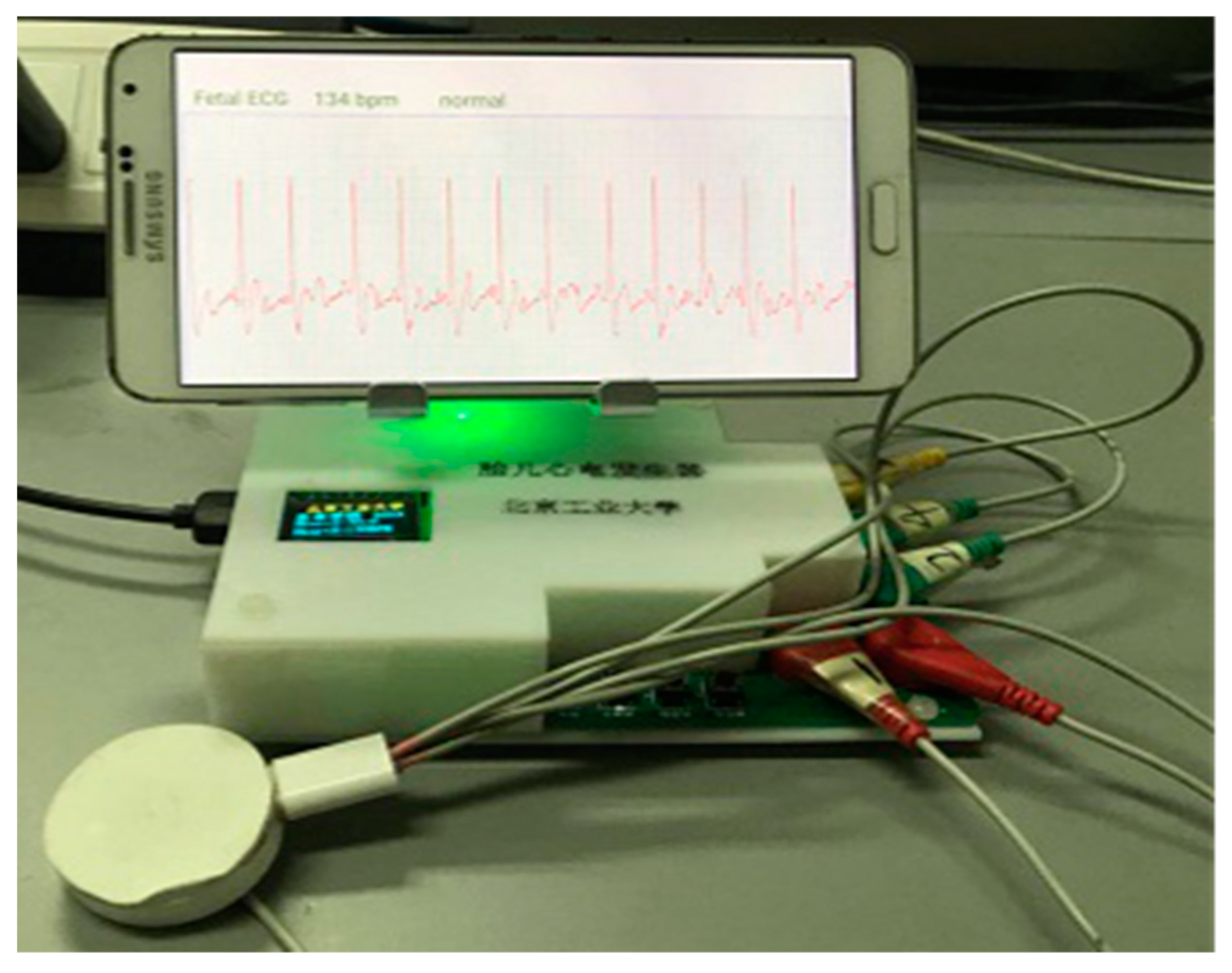 Sensors 19 00446 g011 550