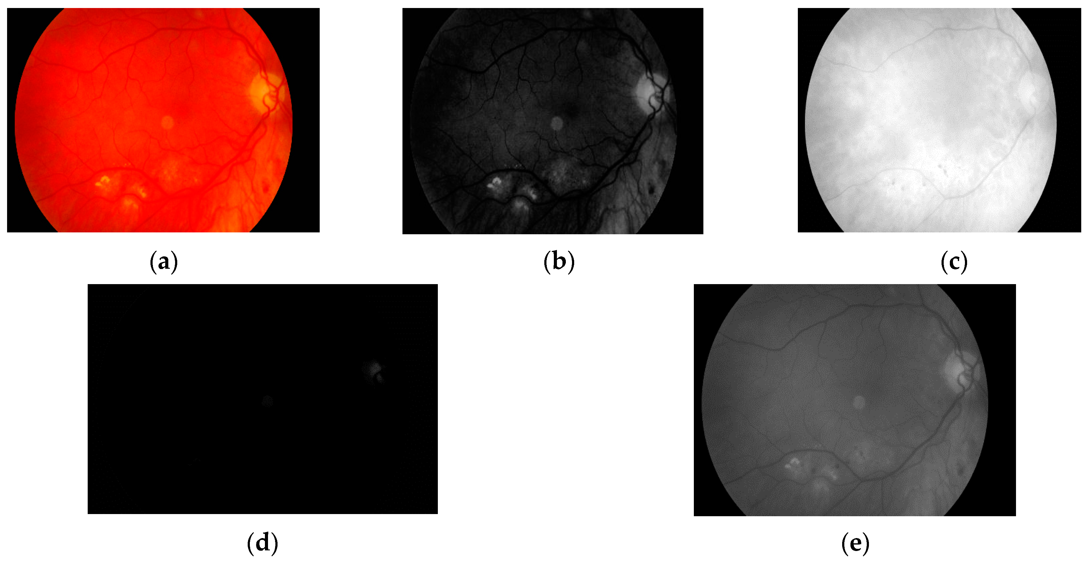 Sensors 19 00695 g005 550