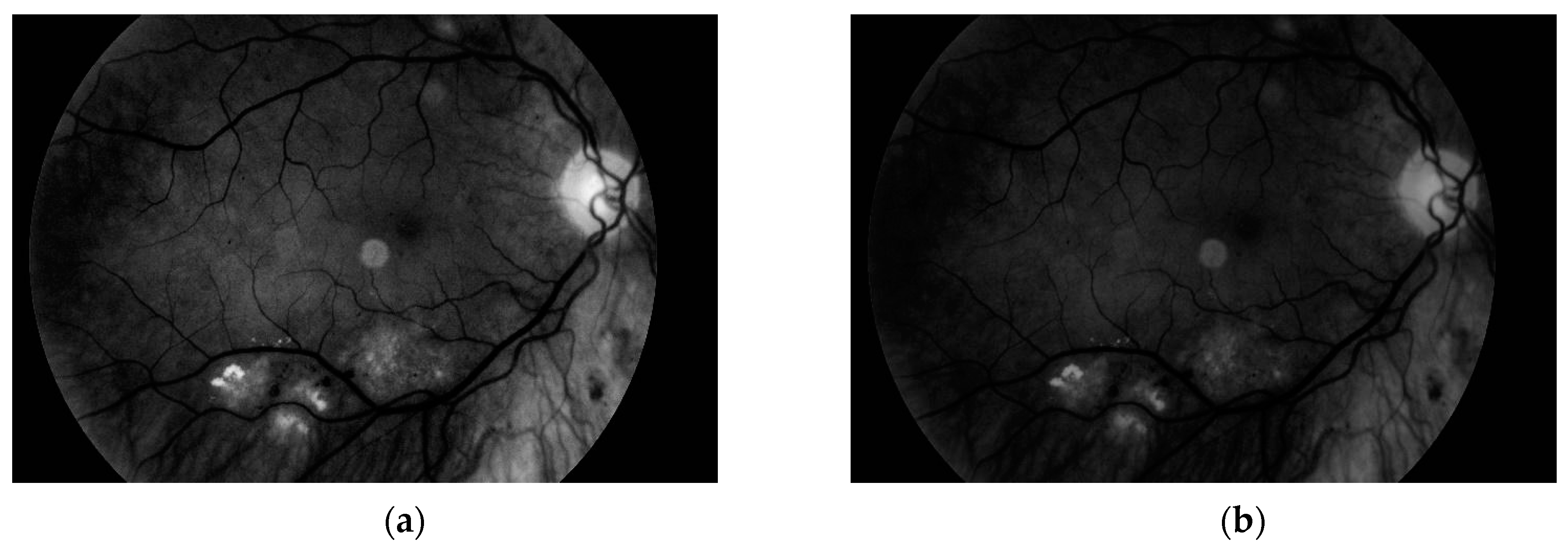 Sensors 19 00695 g007 550